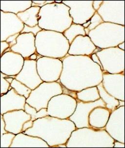 Immunohistochemistry-Paraffin: Perilipin Antibody [NB110-40760] - IHC analysis of formalin fixed paraffin embedded section of fat tissue from mouse with Perilipin antibody at 1:200 dilution. The antibody generated an expected staining in the adipocytes towards periphery of the cells.