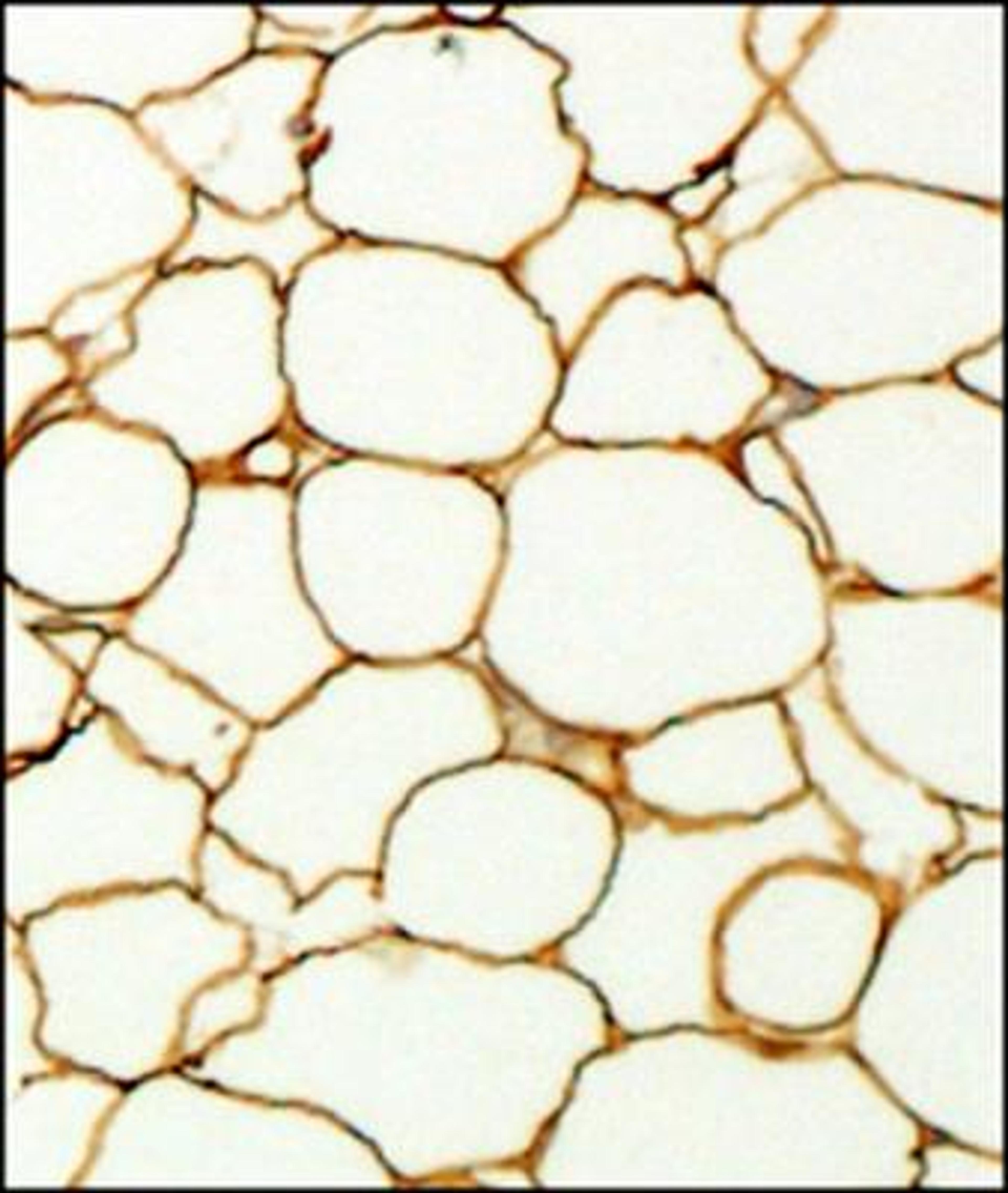 Immunohistochemistry-Paraffin: Perilipin Antibody [NB110-40760] - IHC analysis of formalin fixed paraffin embedded section of fat tissue from mouse with Perilipin antibody at 1:200 dilution. The antibody generated an expected staining in the adipocytes towards periphery of the cells.