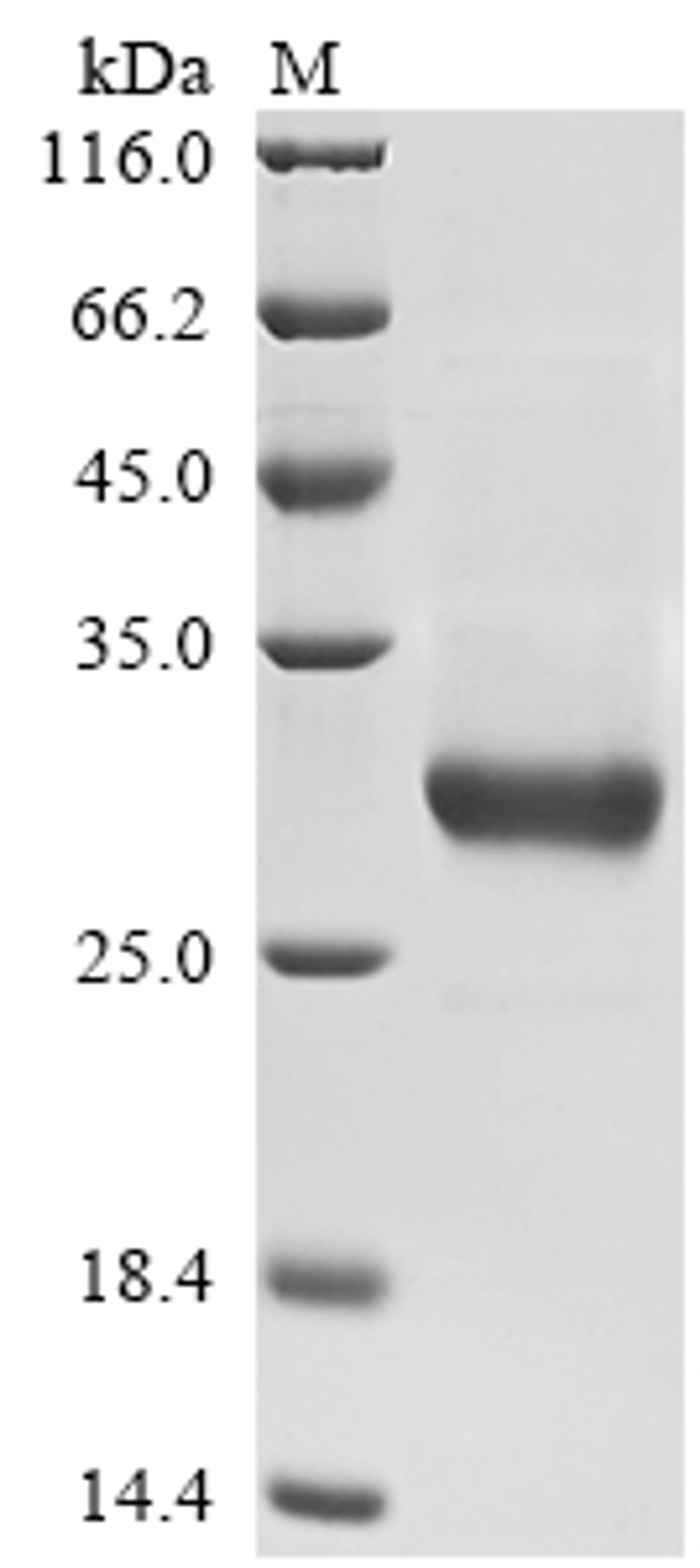 (Tris-Glycine gel) Discontinuous SDS-PAGE (reduced) with 5% enrichment gel and 15% separation gel.