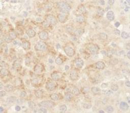 Detection of mouse BAD by immunohistochemistry.