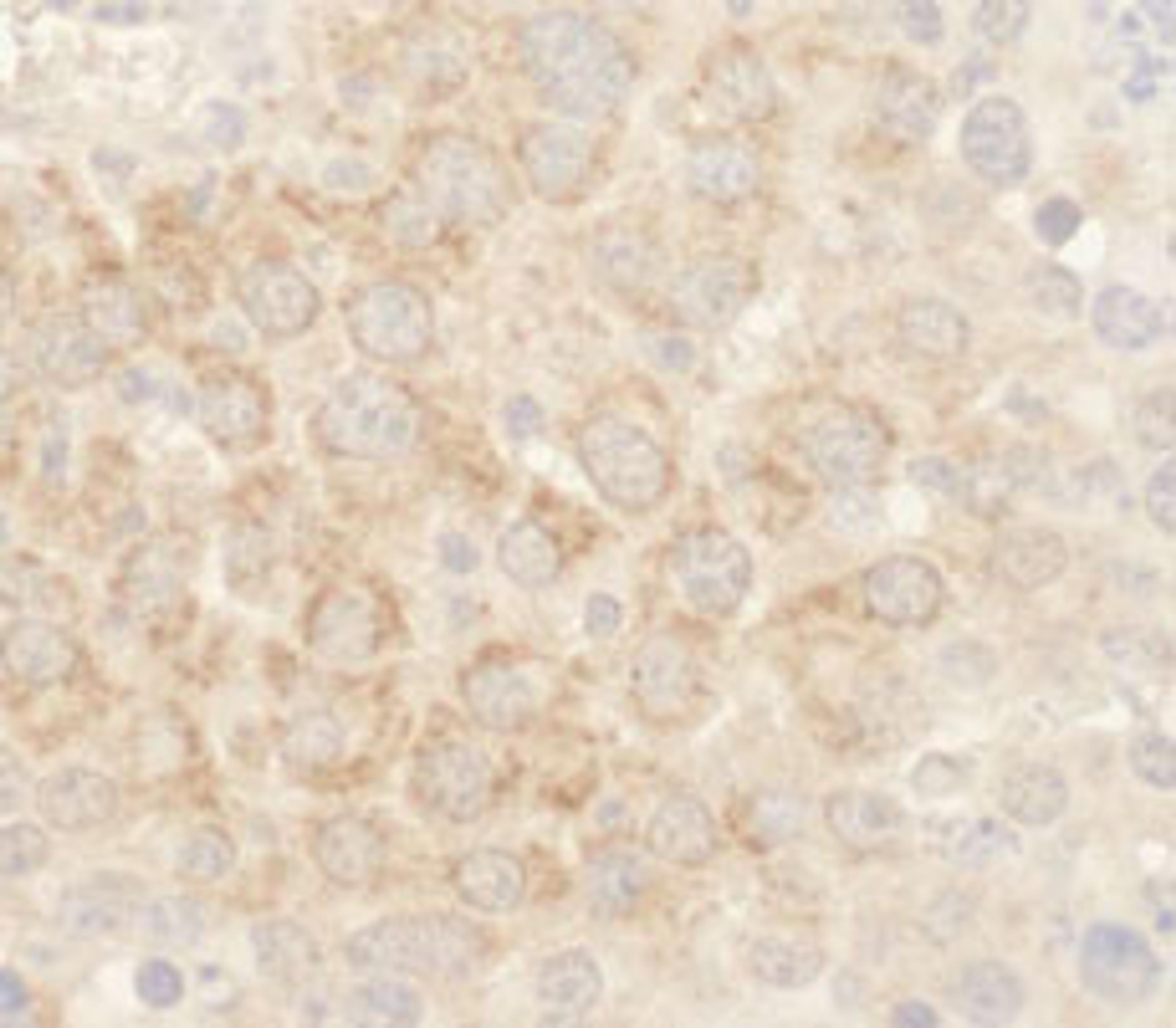 Detection of mouse BAD by immunohistochemistry.