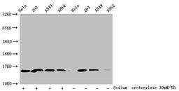 Western Blot. Detected samples: Hela whole cell lysate, 293 whole cell lysate, A549 whole cell lysate, K562 whole cell lysate; Untreated (-) or treated (+) with 30mM Sodium crotonylate for 4h. All lanes: HIST1H2BC antibody at 1:100. Secondary. Goat polyclonal to rabbit IgG at 1/50000 dilution. Predicted band size: 14 kDa. Observed band size: 14 kDa