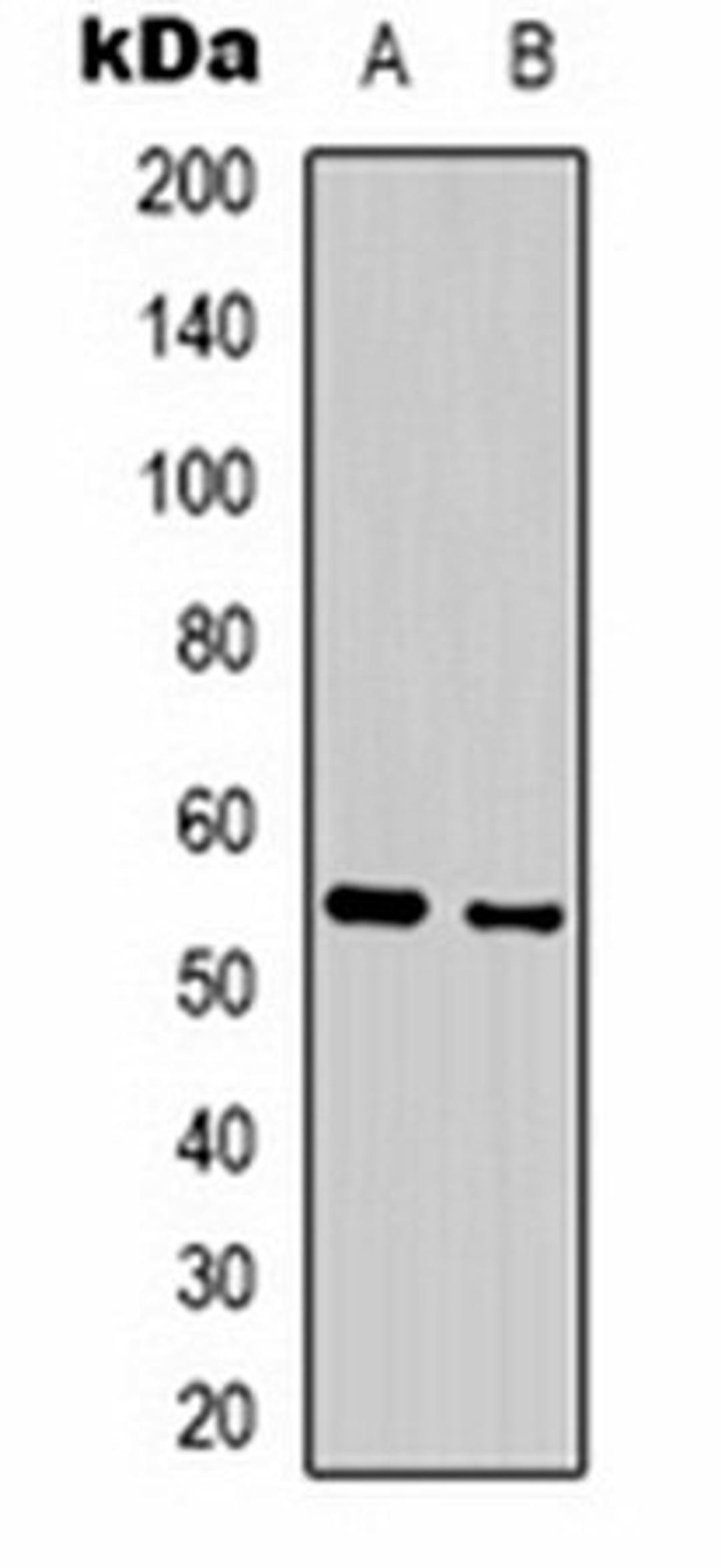 Western blot analysis of mouse brain (Lane 1), rat brain (Lane 2) whole cell lysates using GABRA3 antibody