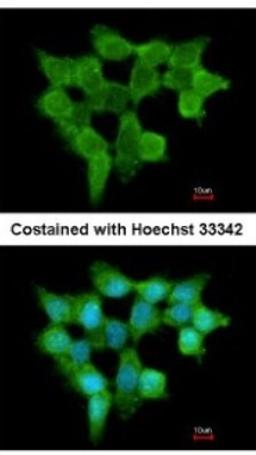 Immunocytochemistry/Immunofluorescence: FMO3 Antibody [NBP1-33583] - Analysis of methanol-fixed A431, using antibody at 1:200 dilution.