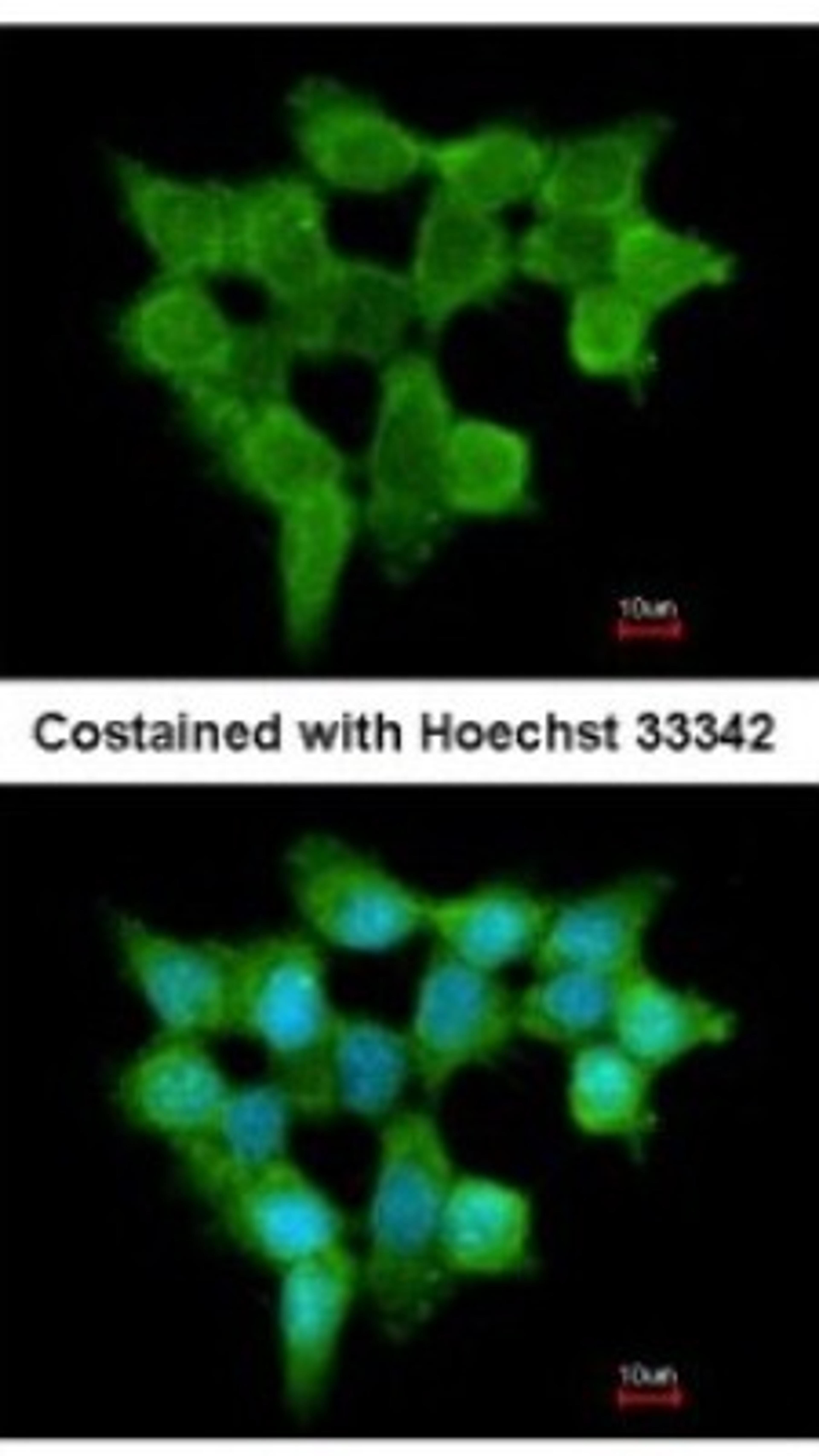 Immunocytochemistry/Immunofluorescence: FMO3 Antibody [NBP1-33583] - Analysis of methanol-fixed A431, using antibody at 1:200 dilution.