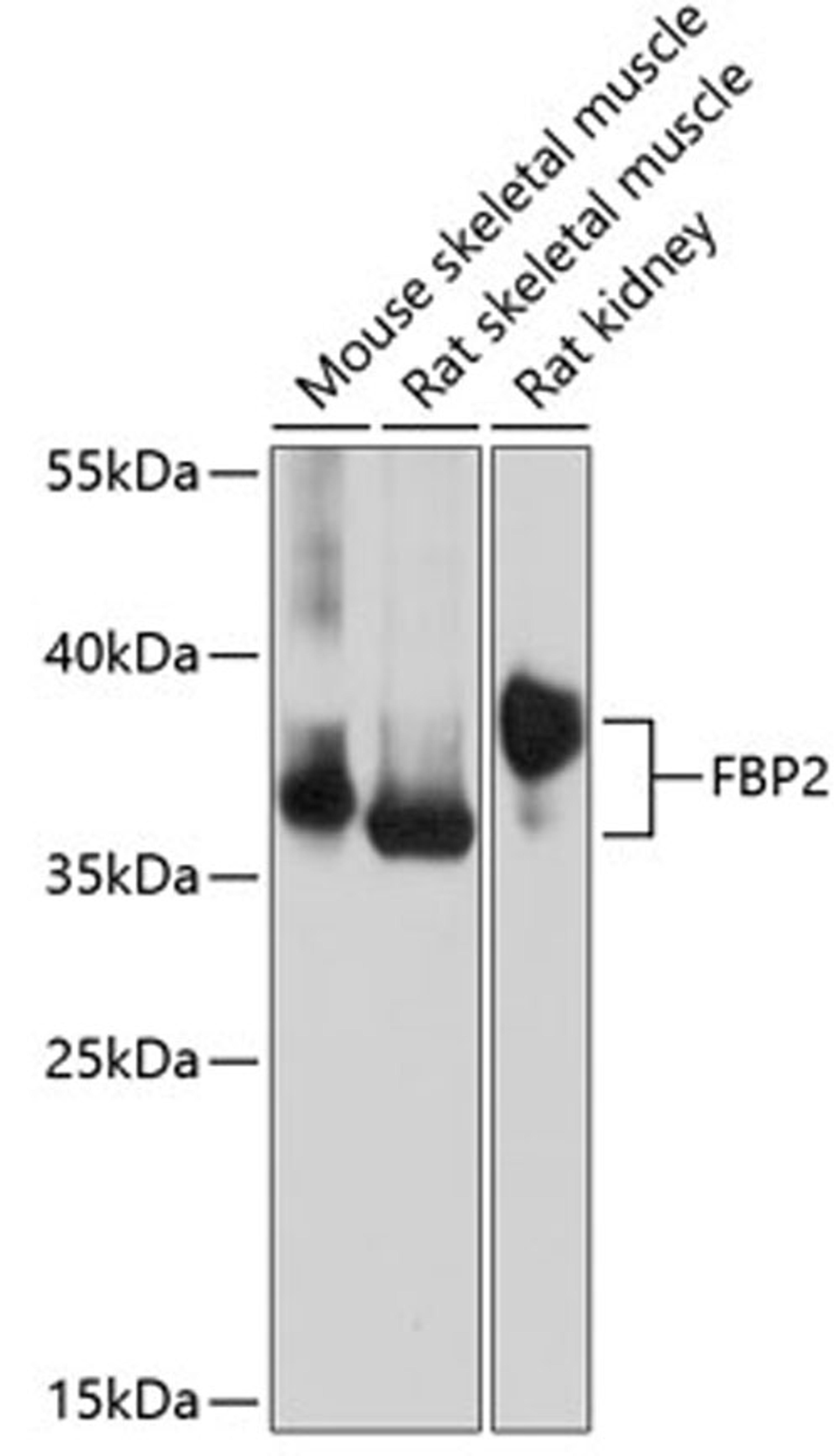 Western blot - FBP2 antibody (A14077)