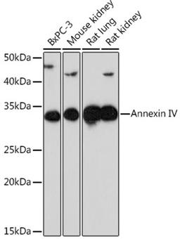 Western blot - Annexin IV Rabbit mAb (A9203)