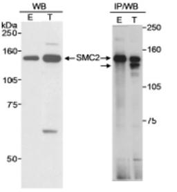 Western Blot: SMC2 Antibody [NB100-373] - Detection of Human SMC2 on HeLa whole cell lysate using NB100-373.