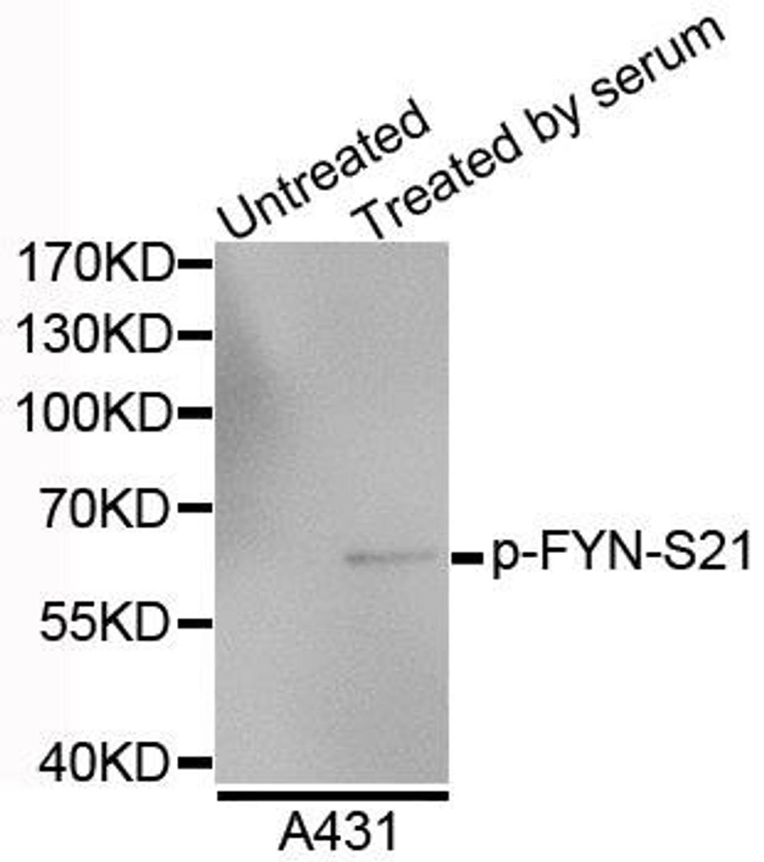 Western blot analysis of extracts of A4731 cells using FYN (Phospho-S21) antibody