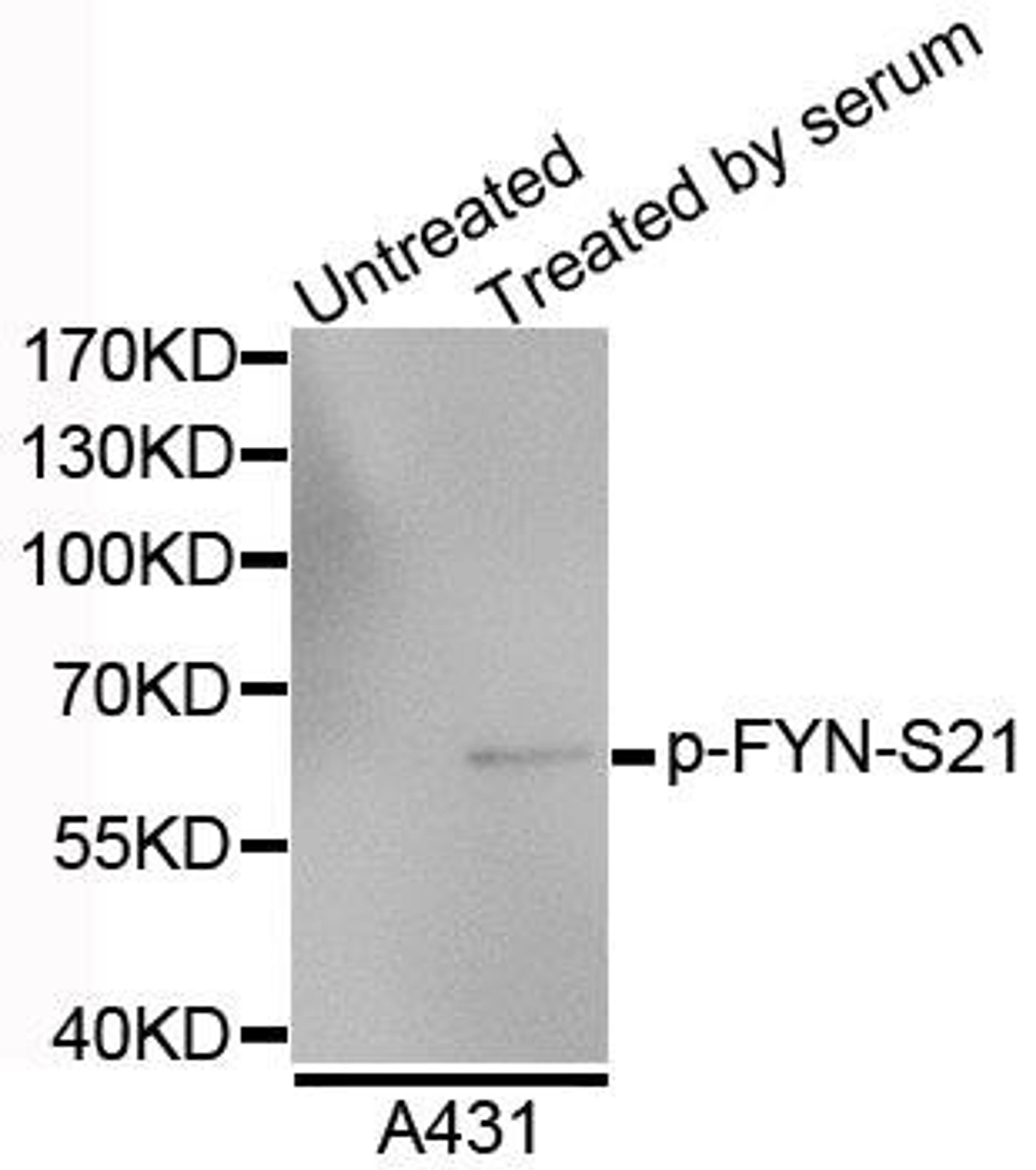 Western blot analysis of extracts of A4731 cells using FYN (Phospho-S21) antibody