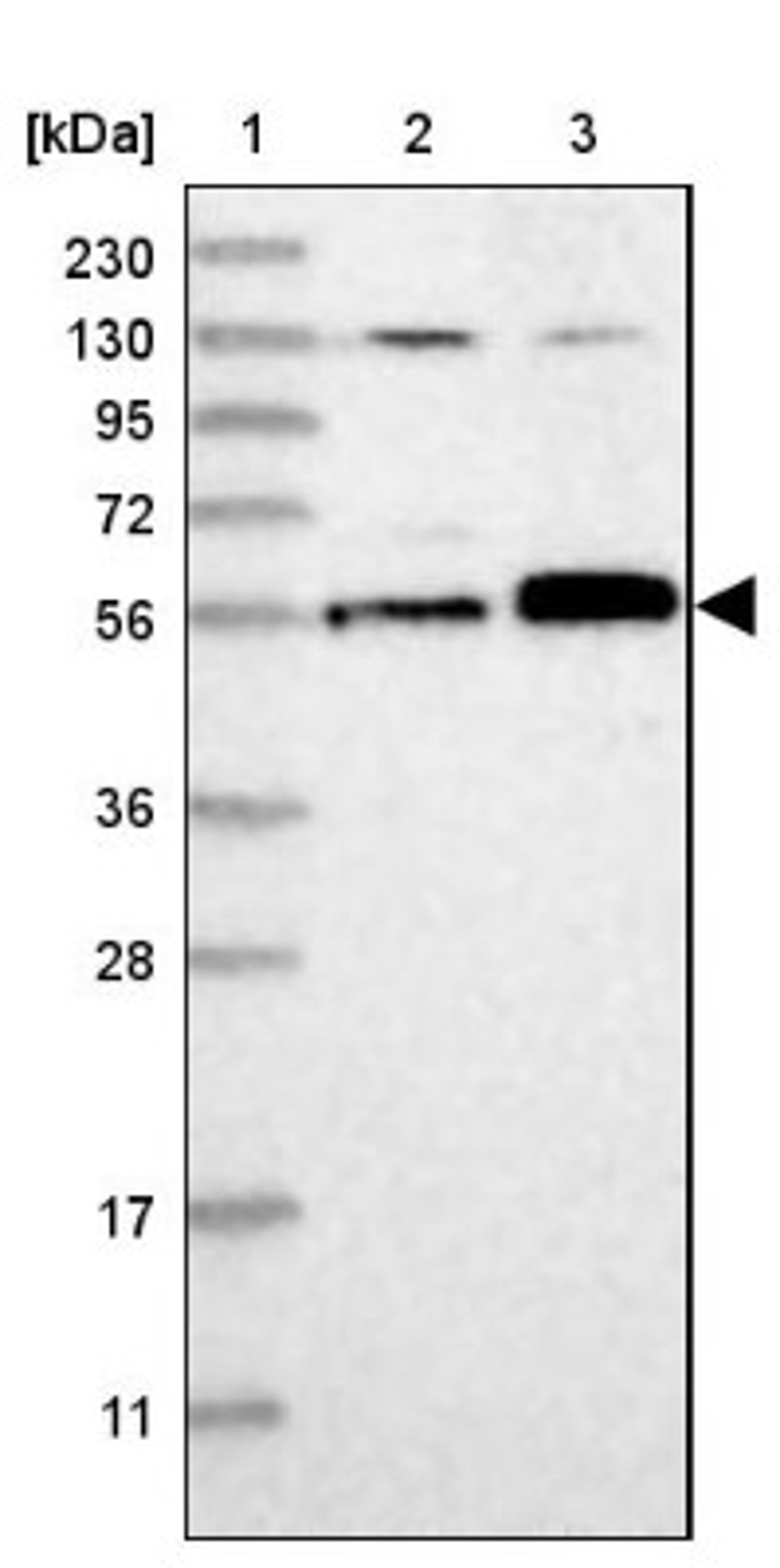 Western Blot: Abraxas Antibody [NBP2-38356] - Lane 1: Marker [kDa] 230, 130, 95, 72, 56, 36, 28, 17, 11<br/>Lane 2: RT-4<br/>Lane 3: U-251 MG