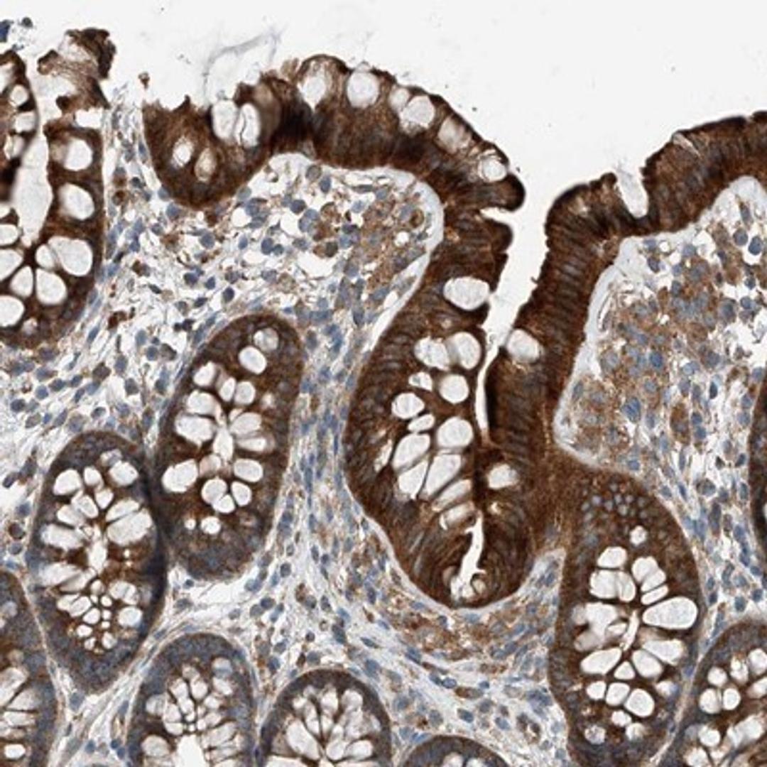 Immunohistochemistry-Paraffin: HOXA5 Antibody [NBP1-83235] - Staining of human colon shows strong cytoplasmic positivity in glandular cells.