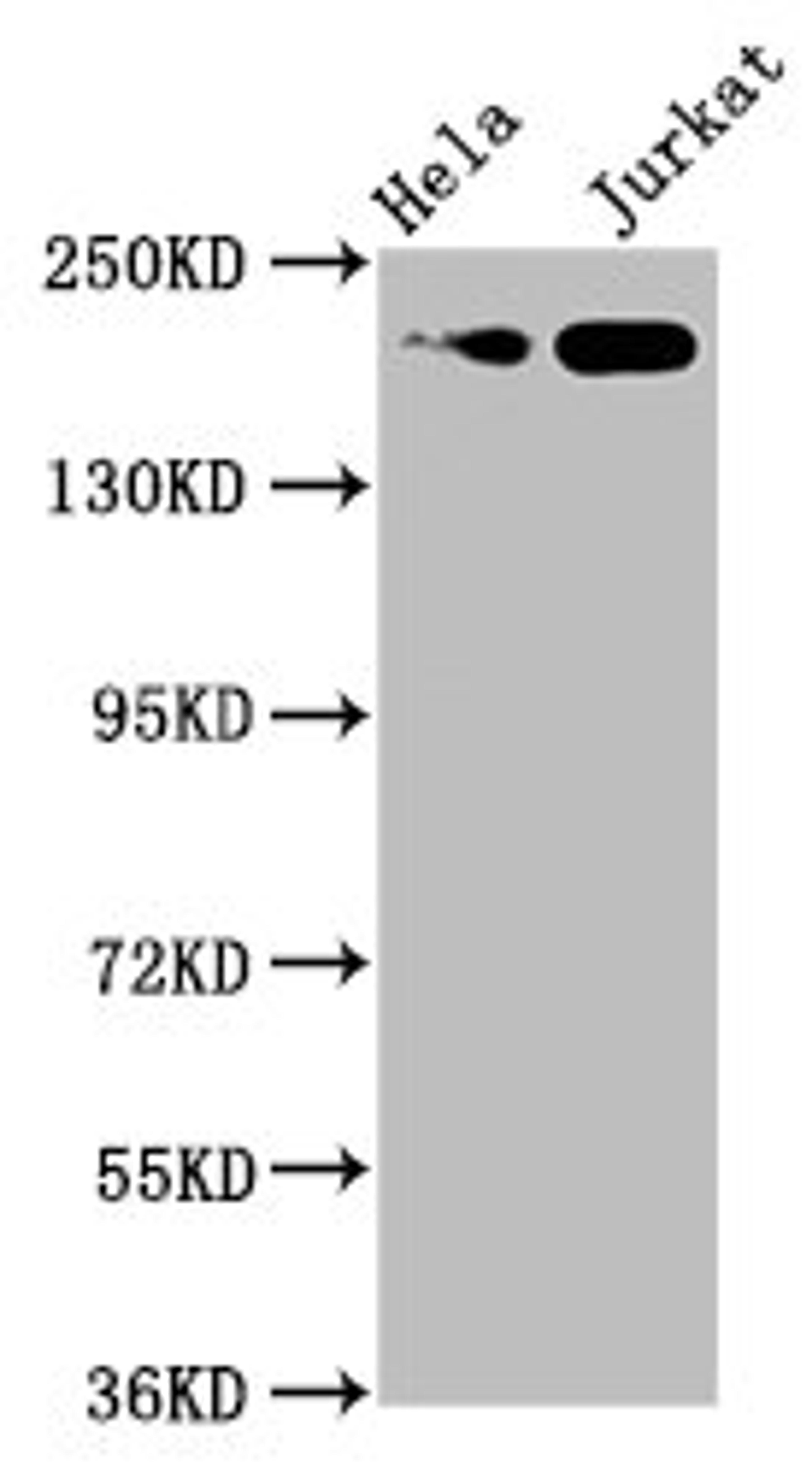Western Blot. Positive WB detected in: Hela whole cell lysate, Jurkat whole cell lysate. All lanes: MYH2 antibody at 1:1250. Secondary. Goat polyclonal to rabbit IgG at 1/50000 dilution. Predicted band size: 224, 80 kDa. Observed band size: 224 kDa. 