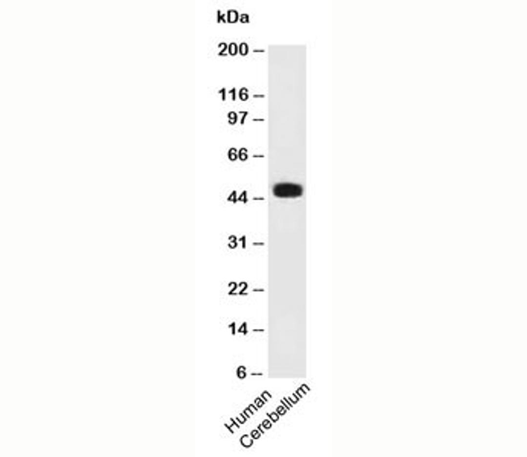 Western blot testing of human samples using PAX6 antibody (PAX6/498).