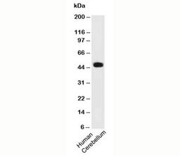 Western blot testing of human samples using PAX6 antibody (PAX6/498).