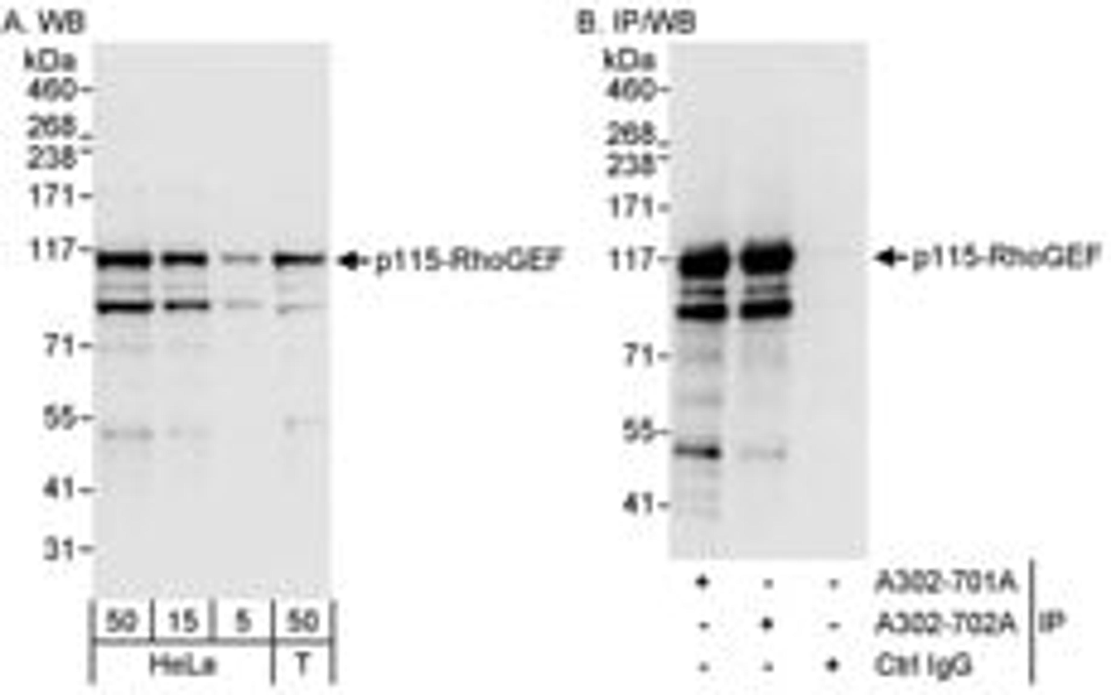 Detection of human p115-RhoGEF by western blot and immunoprecipitation.