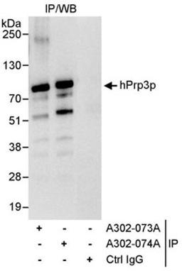 Detection of human hPrp3p by western blot of immunoprecipitates.