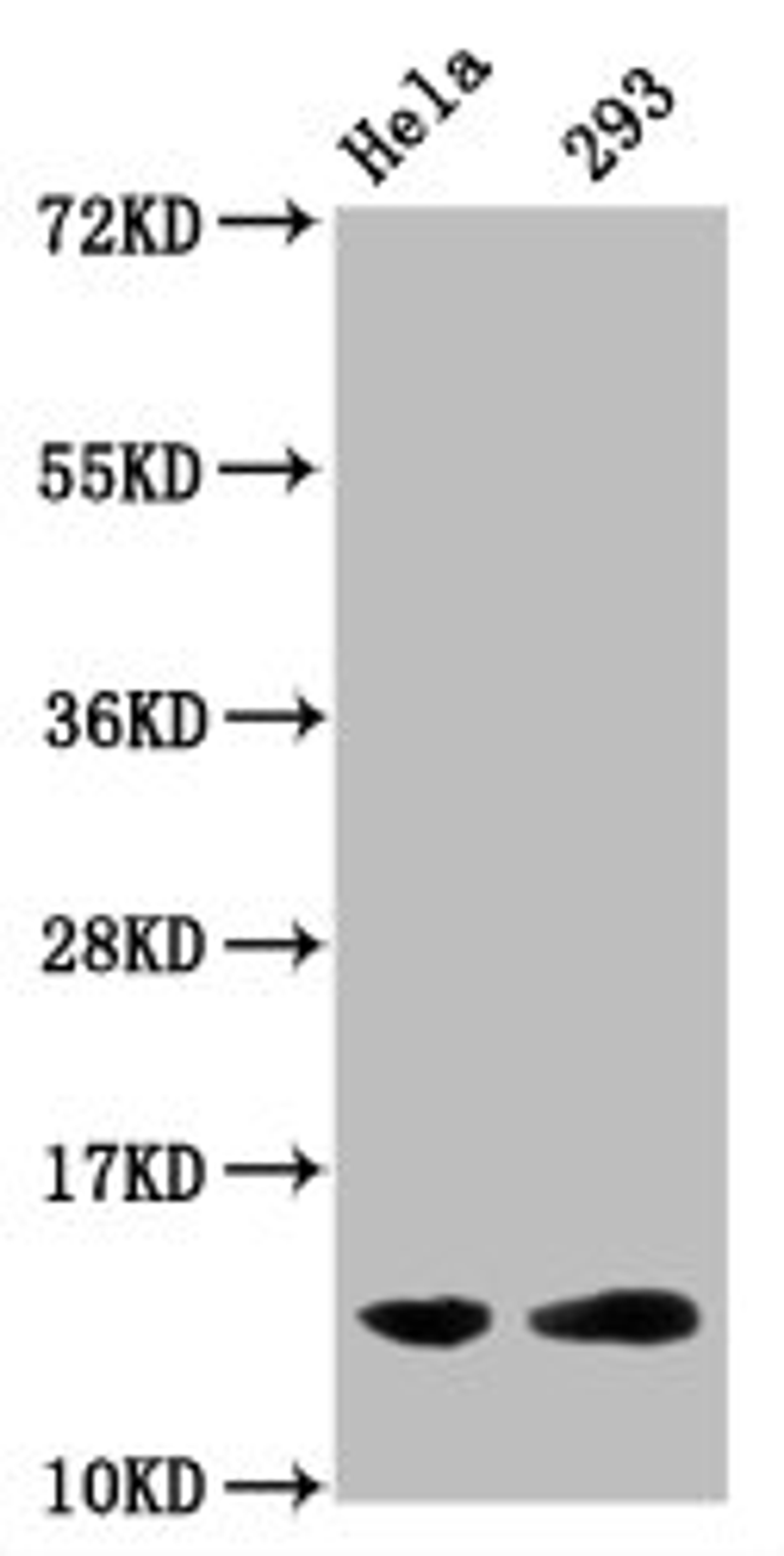 Western Blot. Positive WB detected in: Hela whole cell lysate, 293 whole cell lysate (all treated with 30mM sodium butyrate for 4h). All lanes: HIST1H2BC antibody at 1.7µg/ml. Secondary. Goat polyclonal to rabbit IgG at 1/50000 dilution. Predicted band size: 14 kDa. Observed band size: 14 kDa
