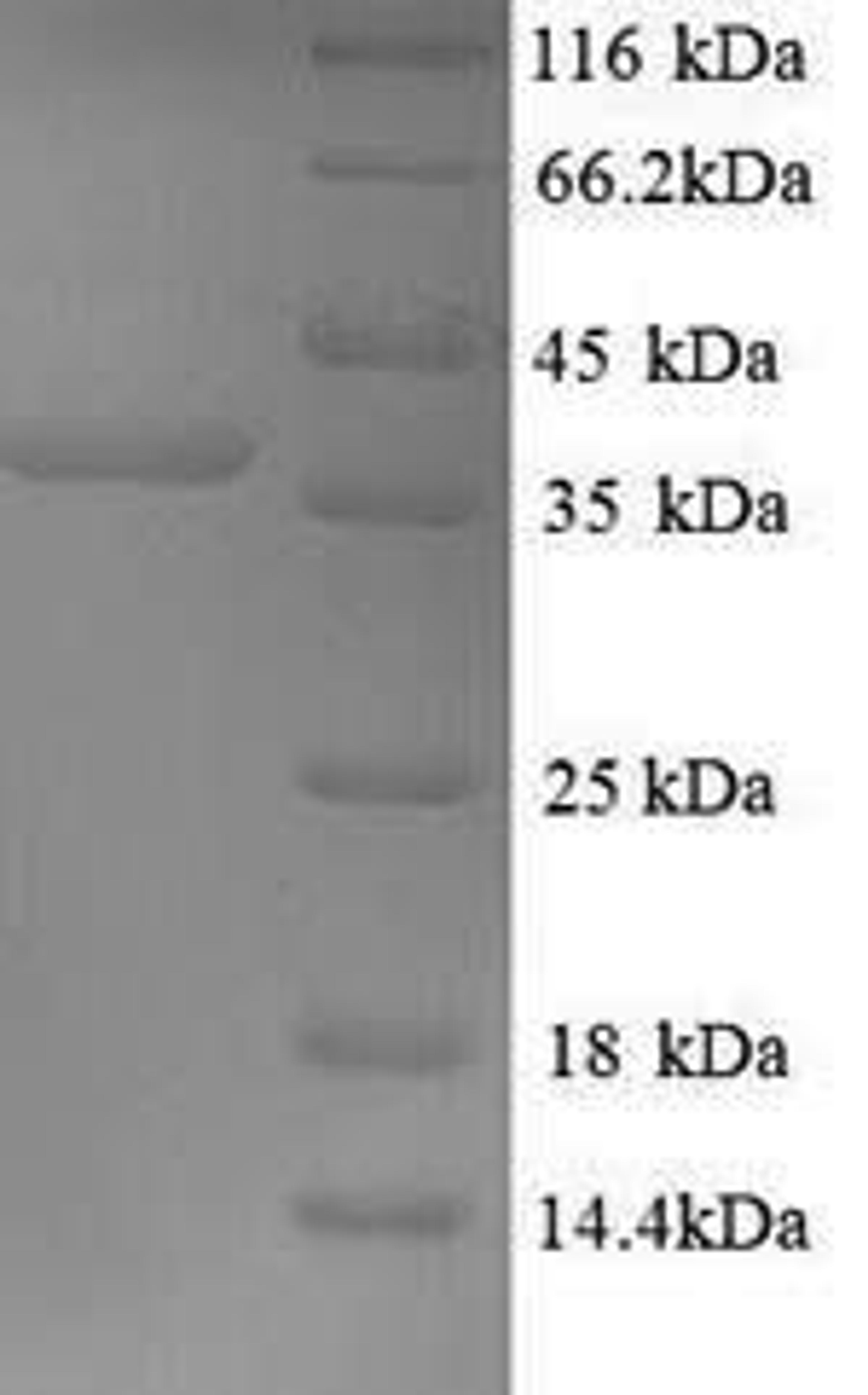 (Tris-Glycine gel) Discontinuous SDS-PAGE (reduced) with 5% enrichment gel and 15% separation gel.