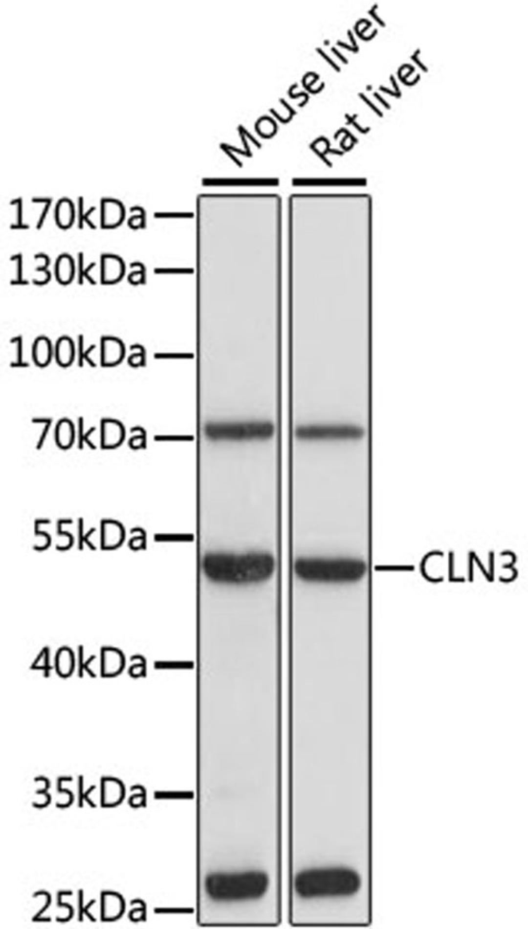 Western blot - CLN3 antibody (A1931)