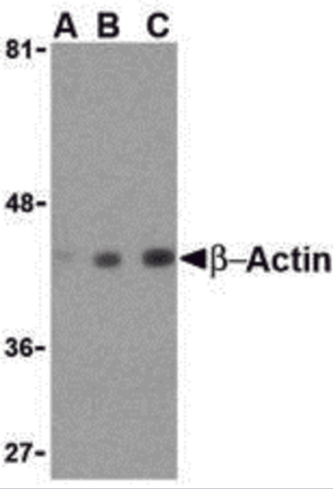 Western blot analysis of beta-actin in HeLa cell lysate with beta-actin antibody at (A) 0.5, (B) 1 and (C) 2 μg/mL.