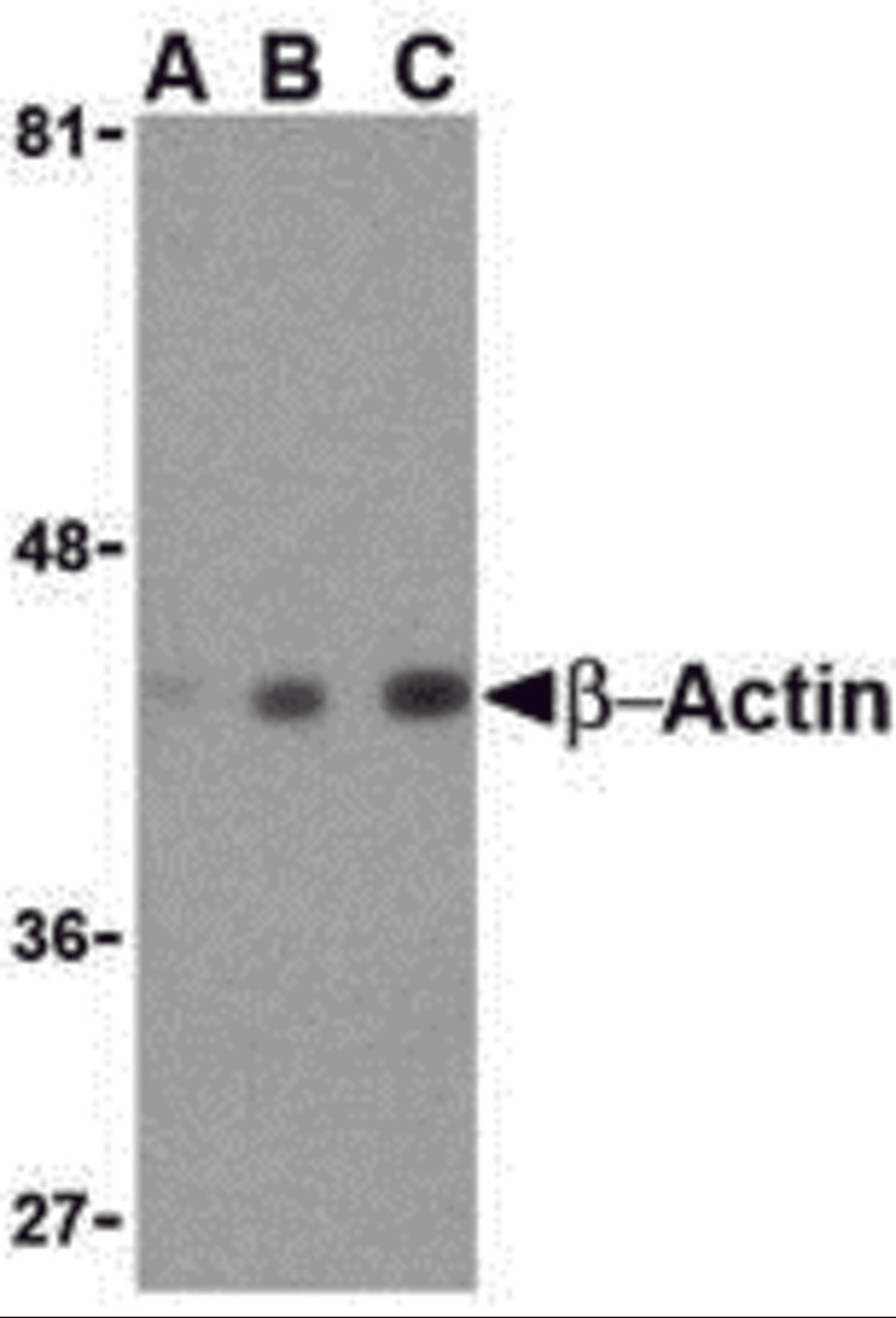 Western blot analysis of beta-actin in HeLa cell lysate with beta-actin antibody at (A) 0.5, (B) 1 and (C) 2 μg/mL.