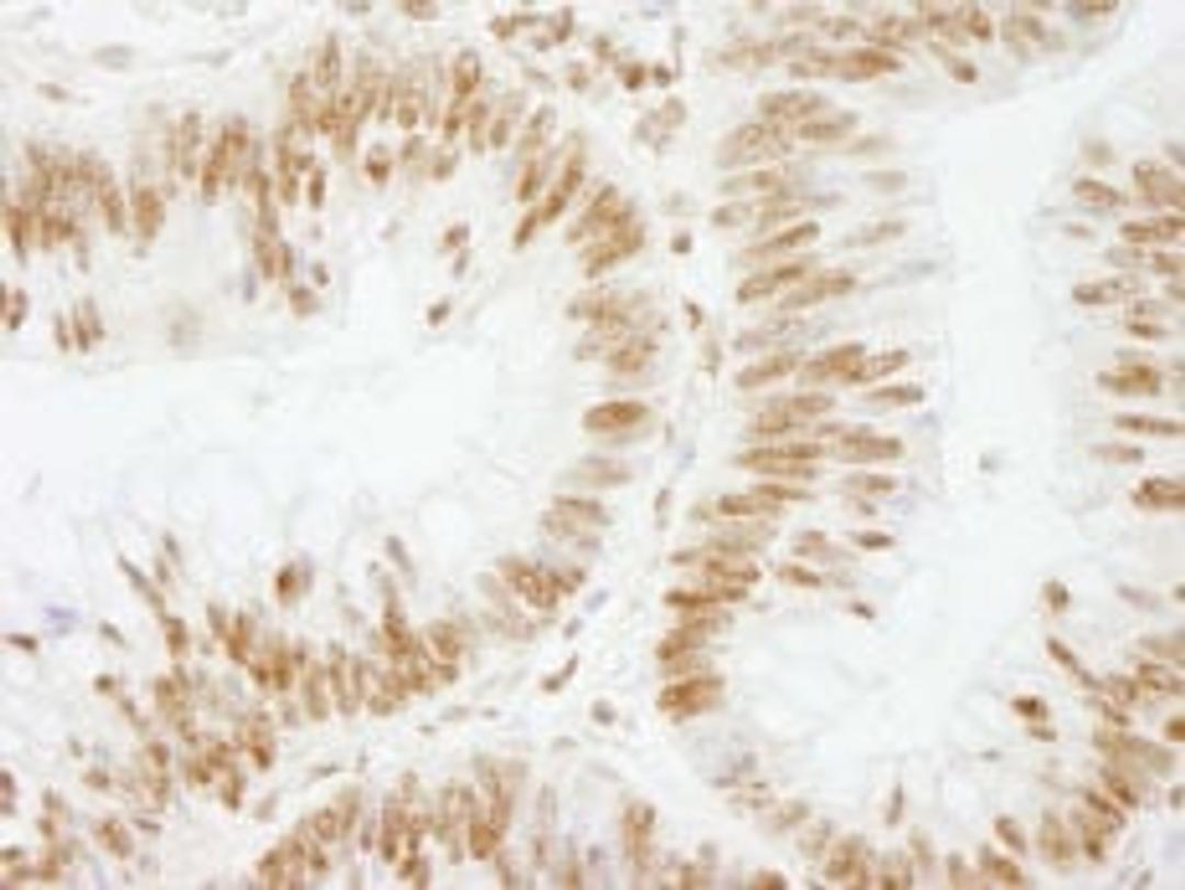 Detection of human CSTF64 by immunohistochemistry.