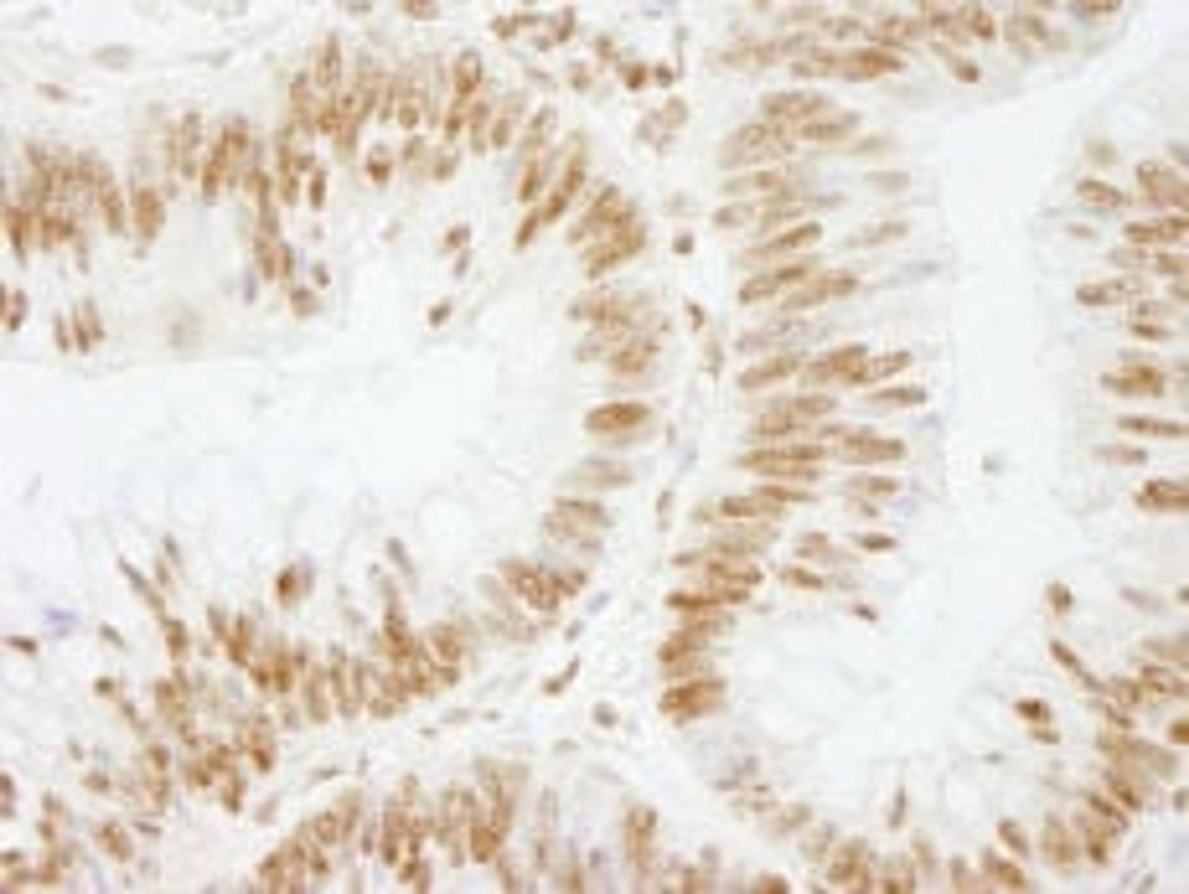 Detection of human CSTF64 by immunohistochemistry.