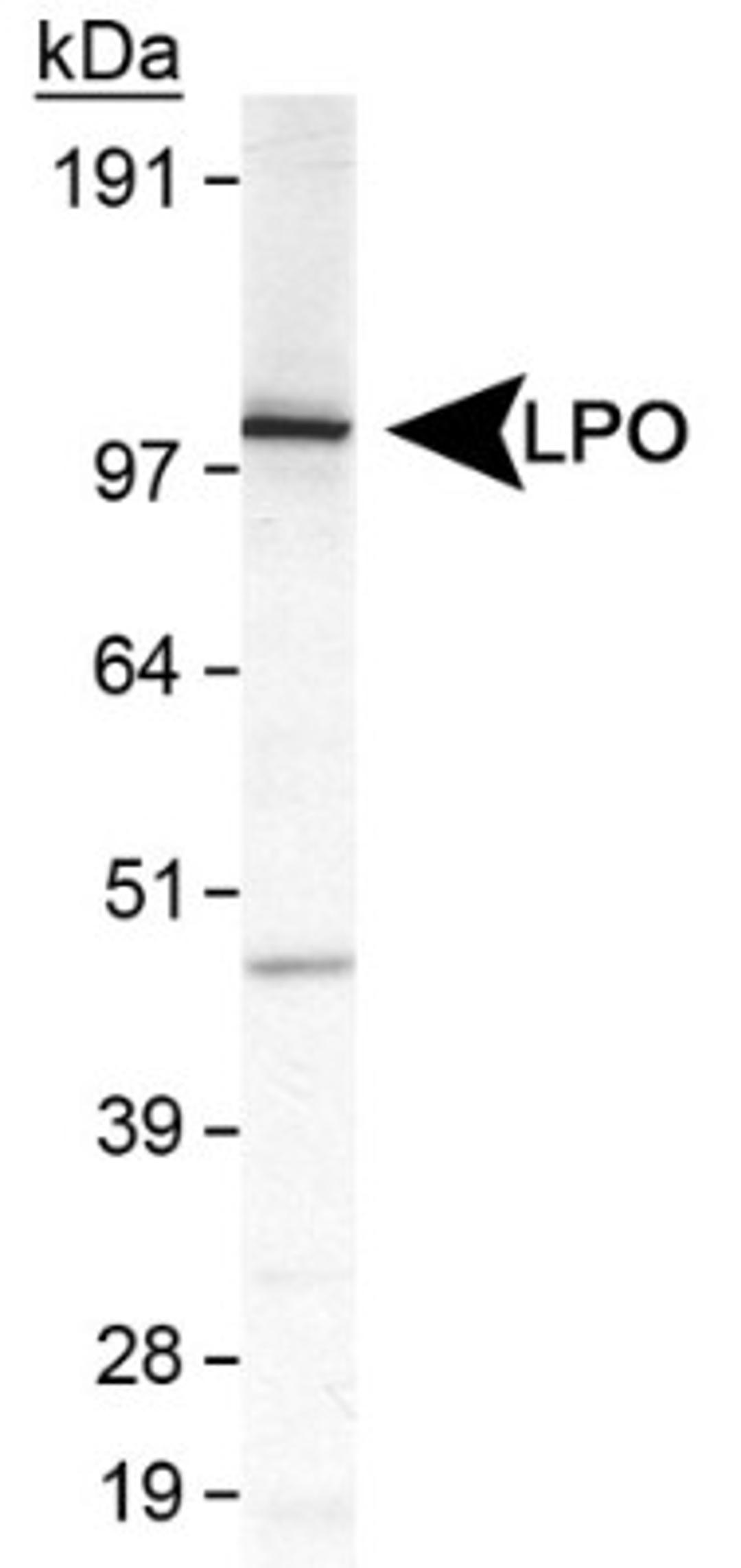 Western Blot: Lactoperoxidase Antibody [NB110-61574] - Detection of LPO in MDA-MB231 cell lysate