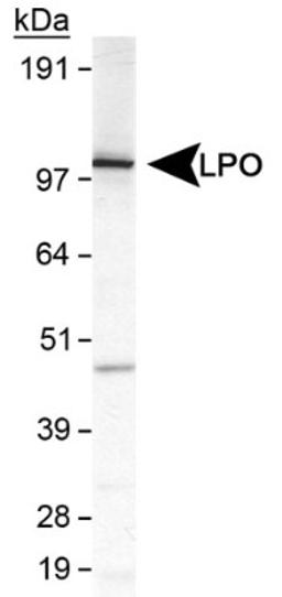 Western Blot: Lactoperoxidase Antibody [NB110-61574] - Detection of LPO in MDA-MB231 cell lysate