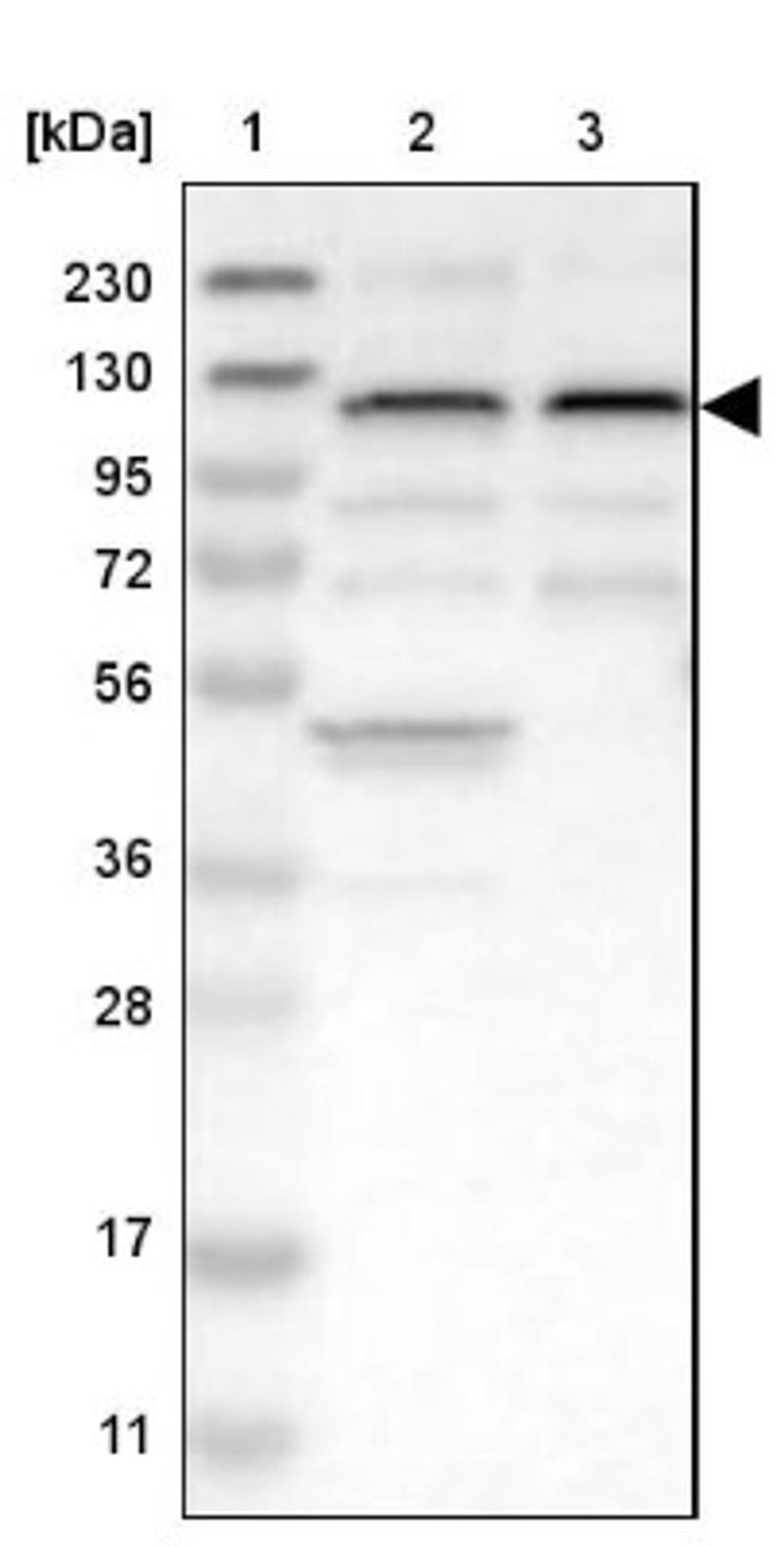 Western Blot: ZSWIM5 Antibody [NBP1-93586] - Lane 1: Marker [kDa] 230, 130, 95, 72, 56, 36, 28, 17, 11<br/>Lane 2: Human cell line RT-4<br/>Lane 3: Human cell line U-251MG sp