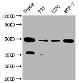Western Blot. Positive WB detected in:HepG2 whole cell lysate, 293 whole cell lysate, U251 whole cell lysate, MCF-7 whole cell lysate. All lanes: UQCRC2 antibody at 1:2000. Secondary. Goat polyclonal to rabbit IgG at 1/50000 dilution. Predicted band size: 49 kDa. Observed band size: 49 kDa. 