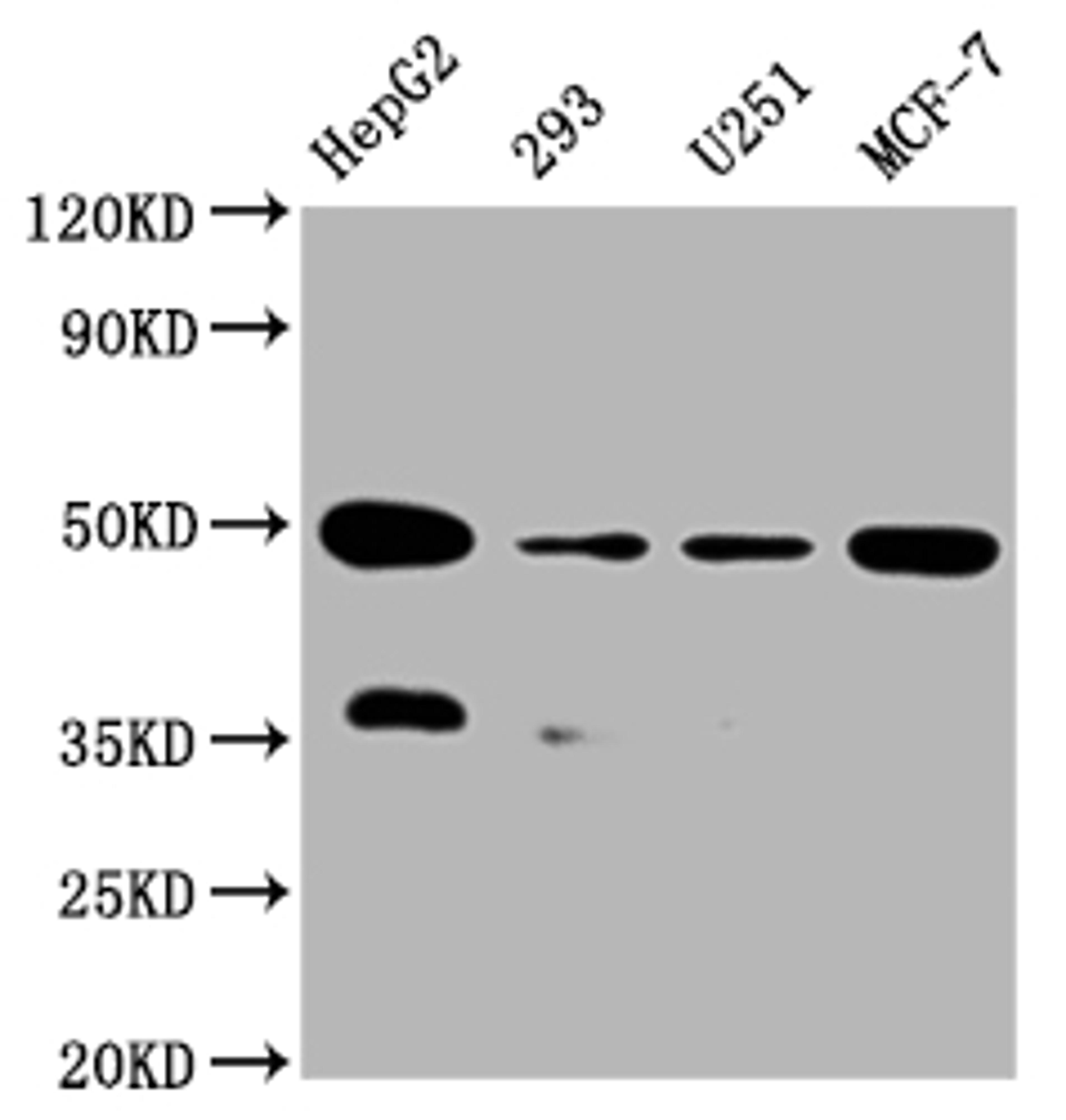 Western Blot. Positive WB detected in:HepG2 whole cell lysate, 293 whole cell lysate, U251 whole cell lysate, MCF-7 whole cell lysate. All lanes: UQCRC2 antibody at 1:2000. Secondary. Goat polyclonal to rabbit IgG at 1/50000 dilution. Predicted band size: 49 kDa. Observed band size: 49 kDa. 