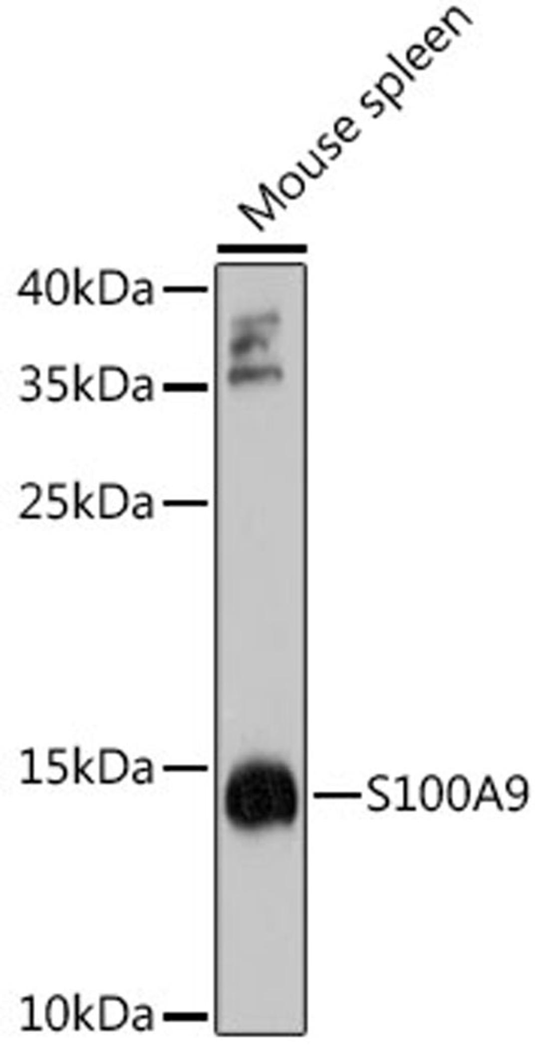 Western blot - S100A9 antibody (A9842)