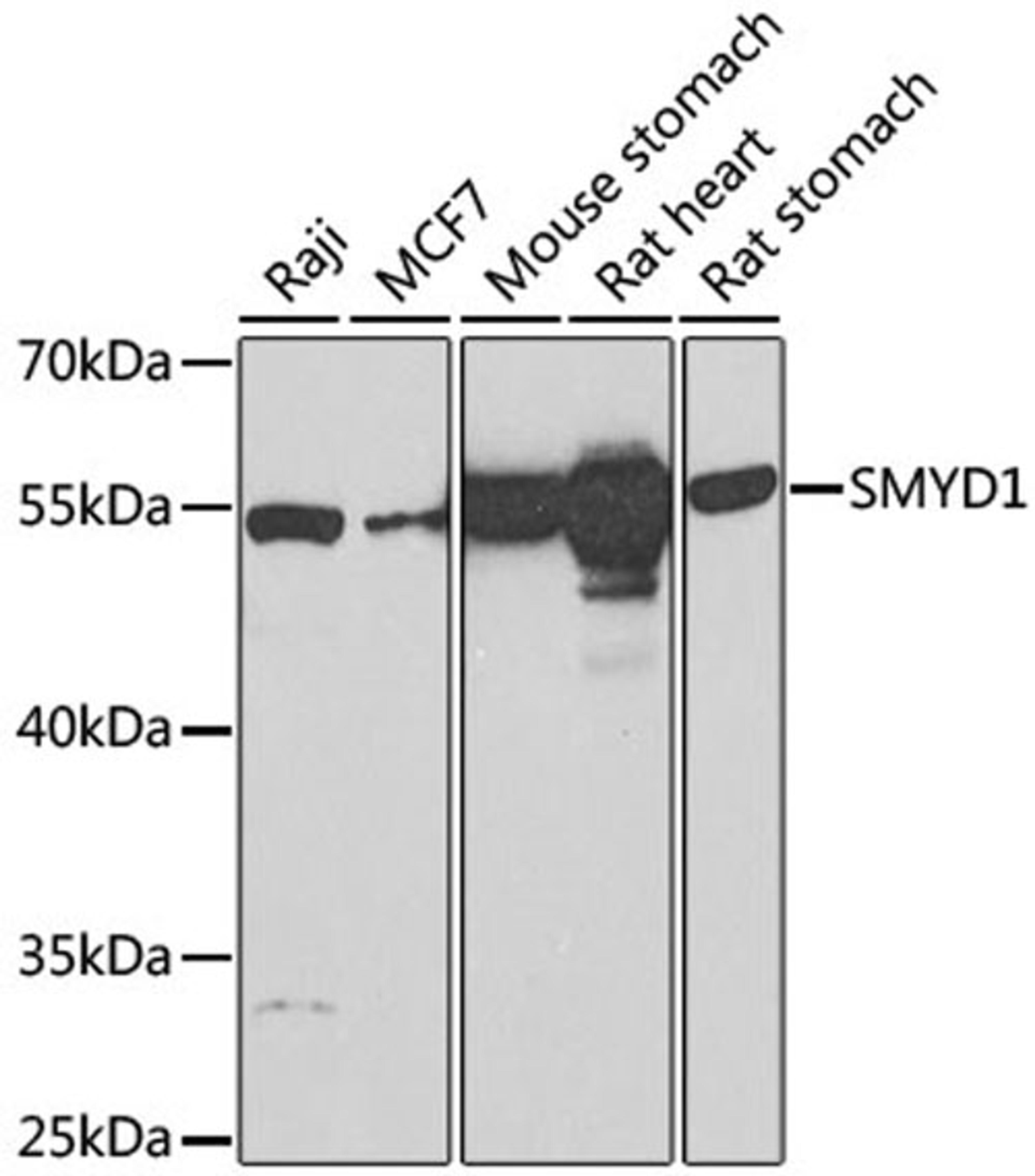 Western blot - SMYD1 Antibody (A2340)