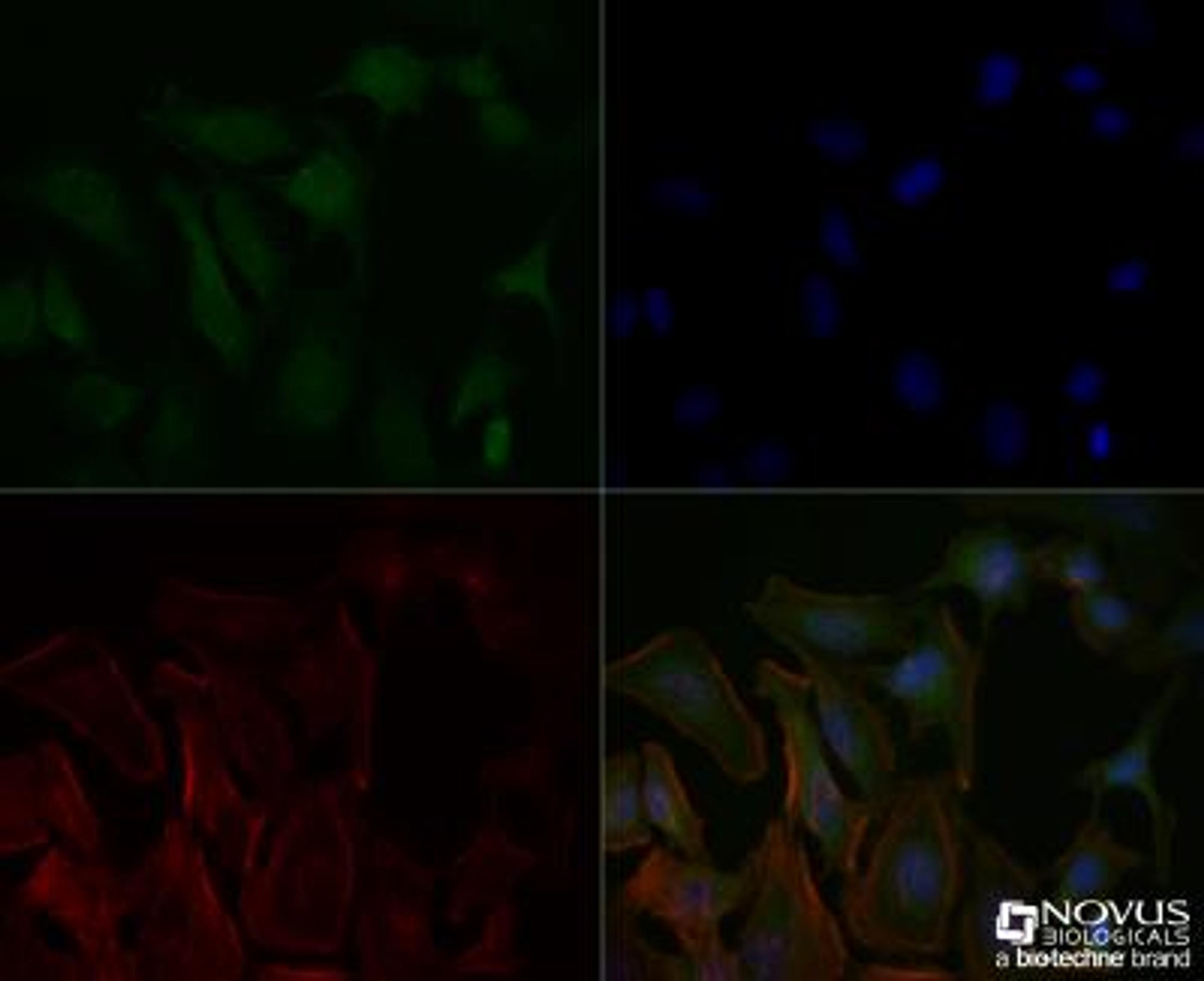 Immunocytochemistry/Immunofluorescence: Delta Np73 Antibody (38C674.2) [NBP2-24873] - HeLa cells were fixed for 10 minutes using 10% formalin and then permeabilized for 5 minutes using 1X TBS + 0.5% Triton-X100. The cells were incubated with anti-Delta Np73 (38C674.2) NBP2-24873 at a 1:50 dilution overnight at 4C and detected with an anti-mouse Dylight 488 (Green) at a 1:500 dilution. Actin was counterstained with Phalloidin 568 (Red) at a 1:200 dilution. Nuclei were counterstained with DAPI (Blue). Cells were imaged using a 40X objective.