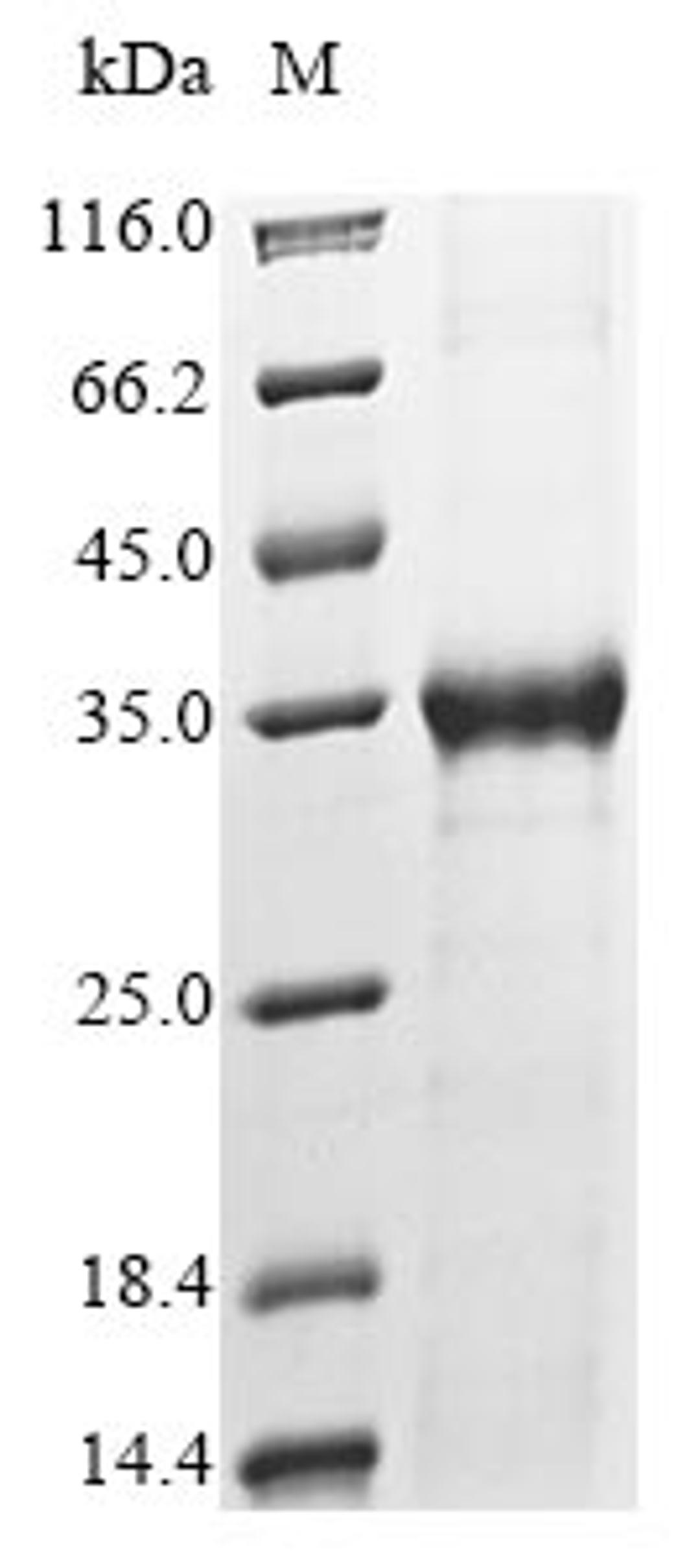 (Tris-Glycine gel) Discontinuous SDS-PAGE (reduced) with 5% enrichment gel and 15% separation gel.