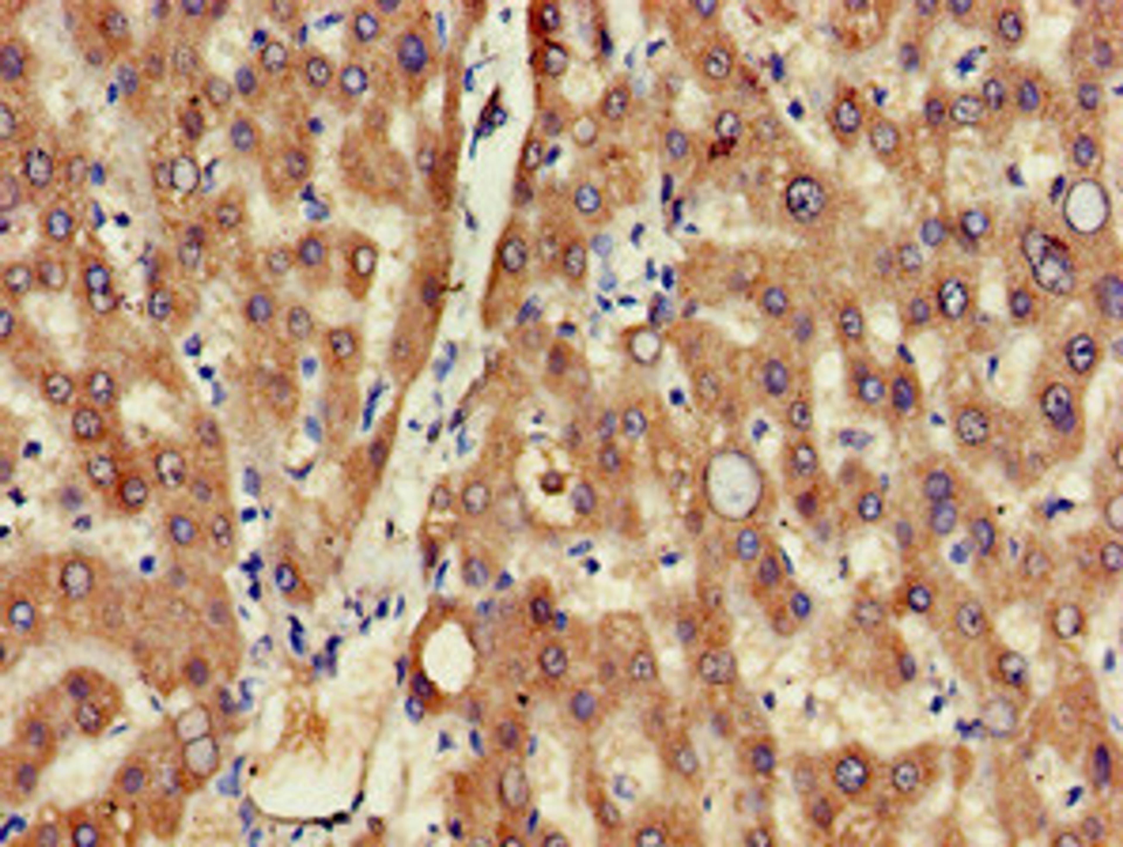Immunohistochemistry of paraffin-embedded human liver tissue using CSB-PA882163LA01HU at dilution of 1:100