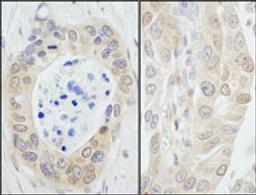 Detection of human NMI by immunohistochemistry.