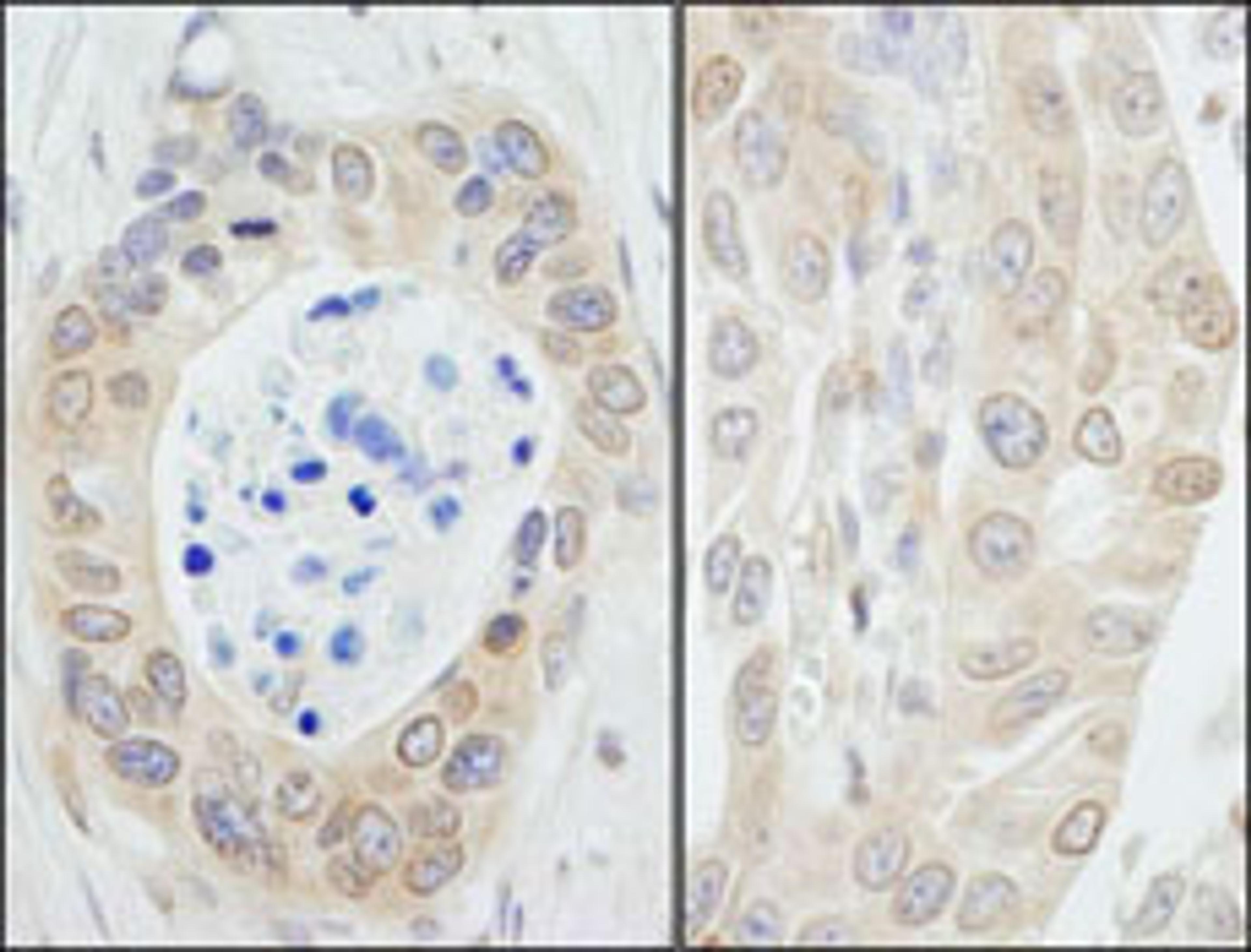 Detection of human NMI by immunohistochemistry.