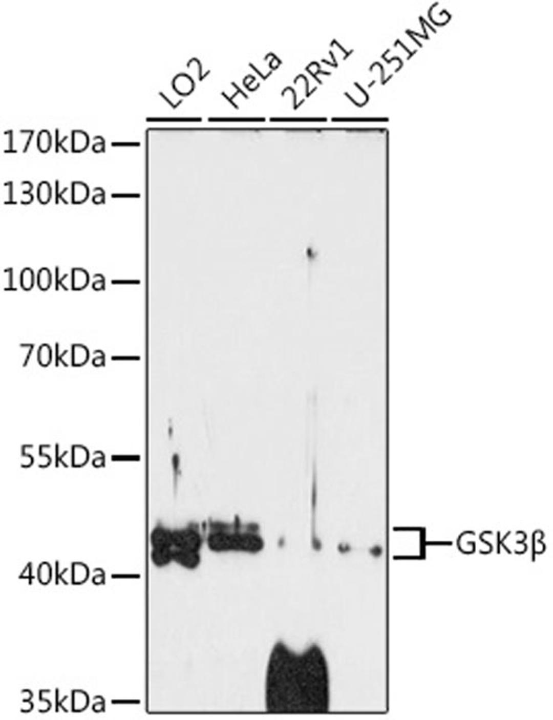 Western blot - GSK3ß antibody (A3174)