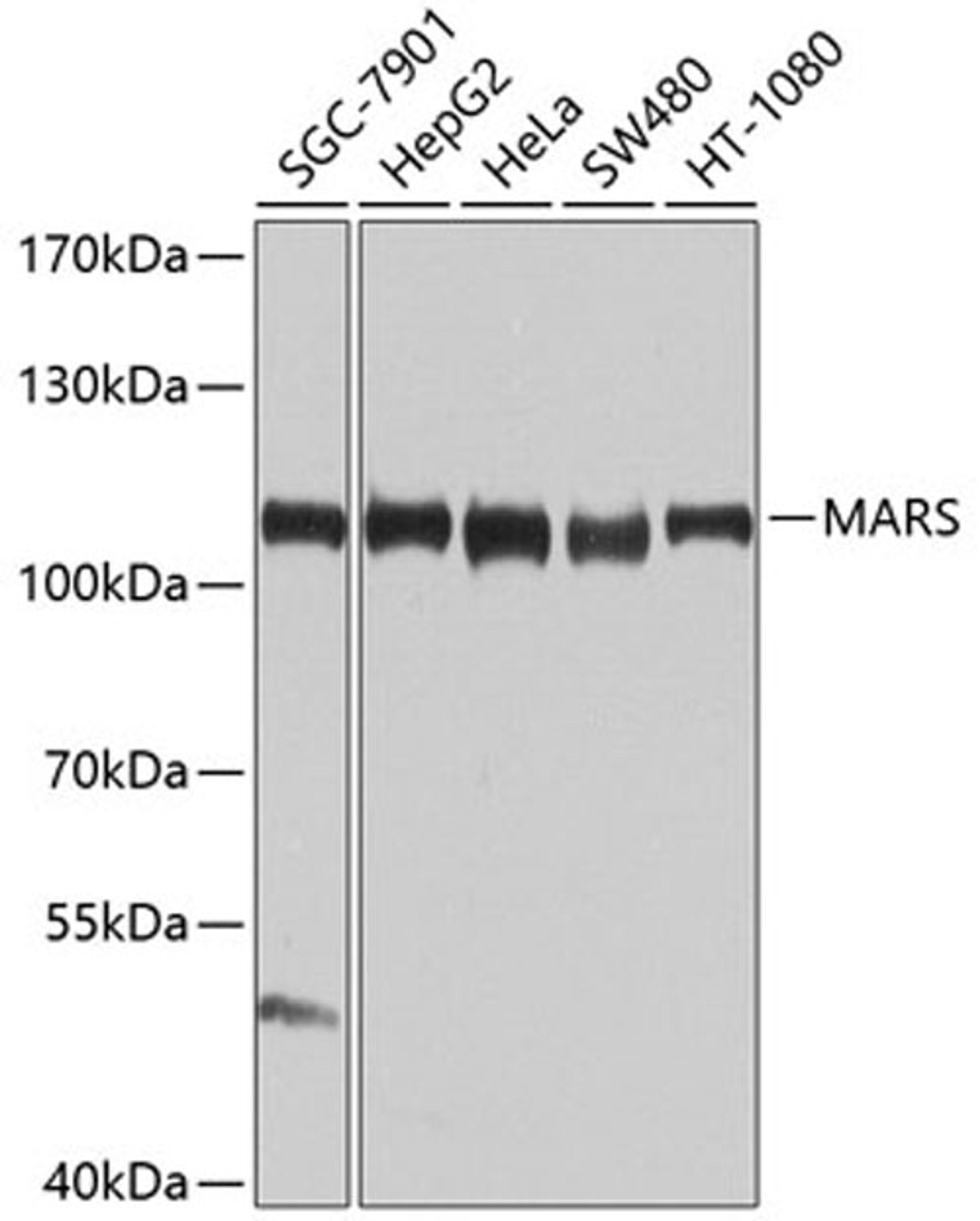 Western blot - MARS antibody (A9938)