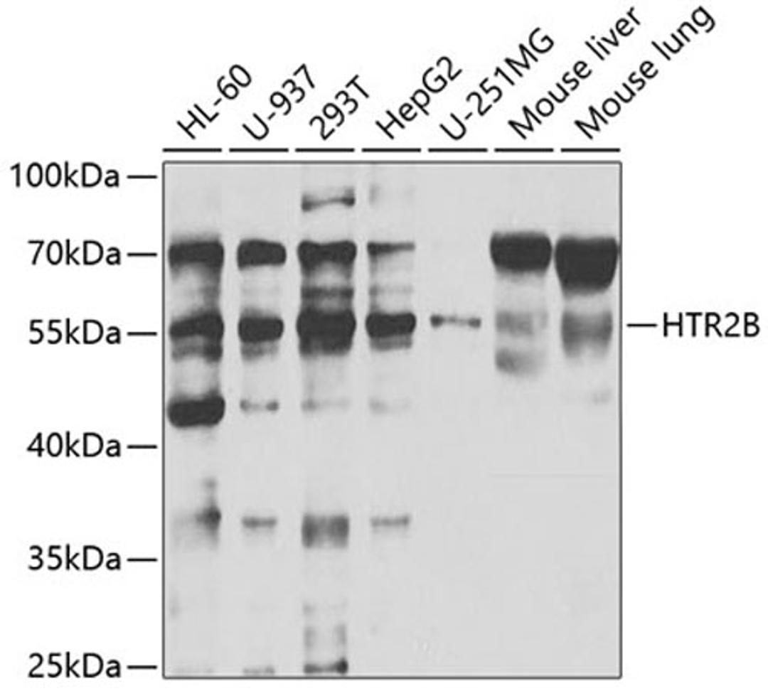 Western blot - HTR2B antibody (A5670)