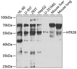 Western blot - HTR2B antibody (A5670)