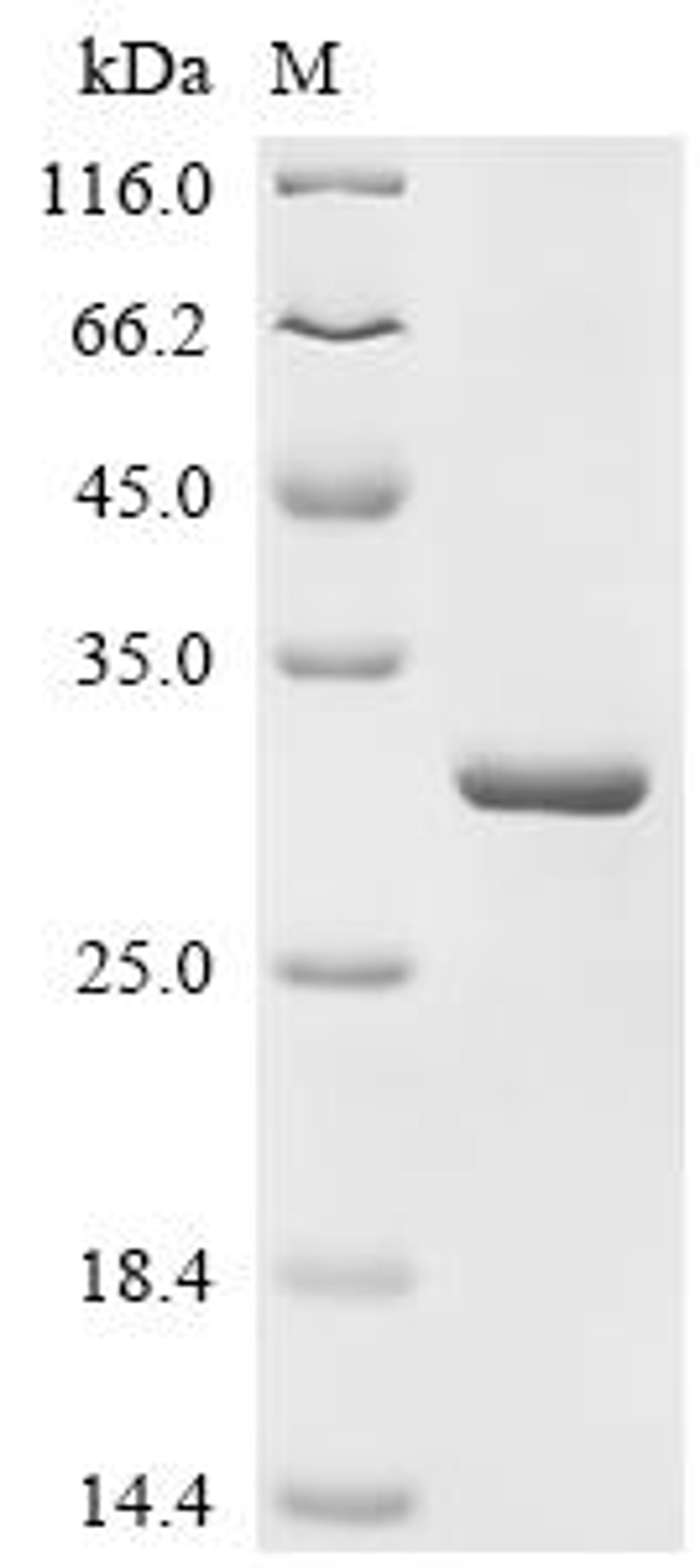 (Tris-Glycine gel) Discontinuous SDS-PAGE (reduced) with 5% enrichment gel and 15% separation gel.