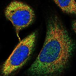 Immunocytochemistry/Immunofluorescence: C4orf27 Antibody [NBP1-93973] - Staining of human cell line U-2 OS shows positivity in cytoplasm & cytoskeleton (cytokinetic bridge).