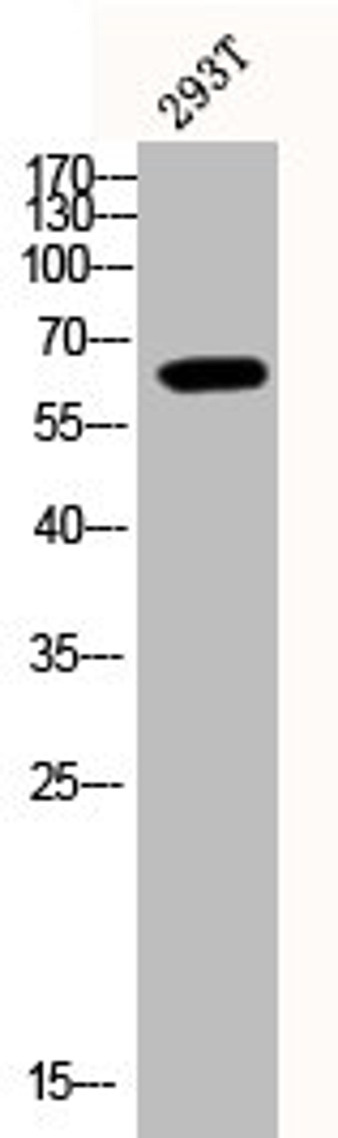 Western Blot analysis of 293T cells using Phospho-Akt1 (Y474) Polyclonal Antibody