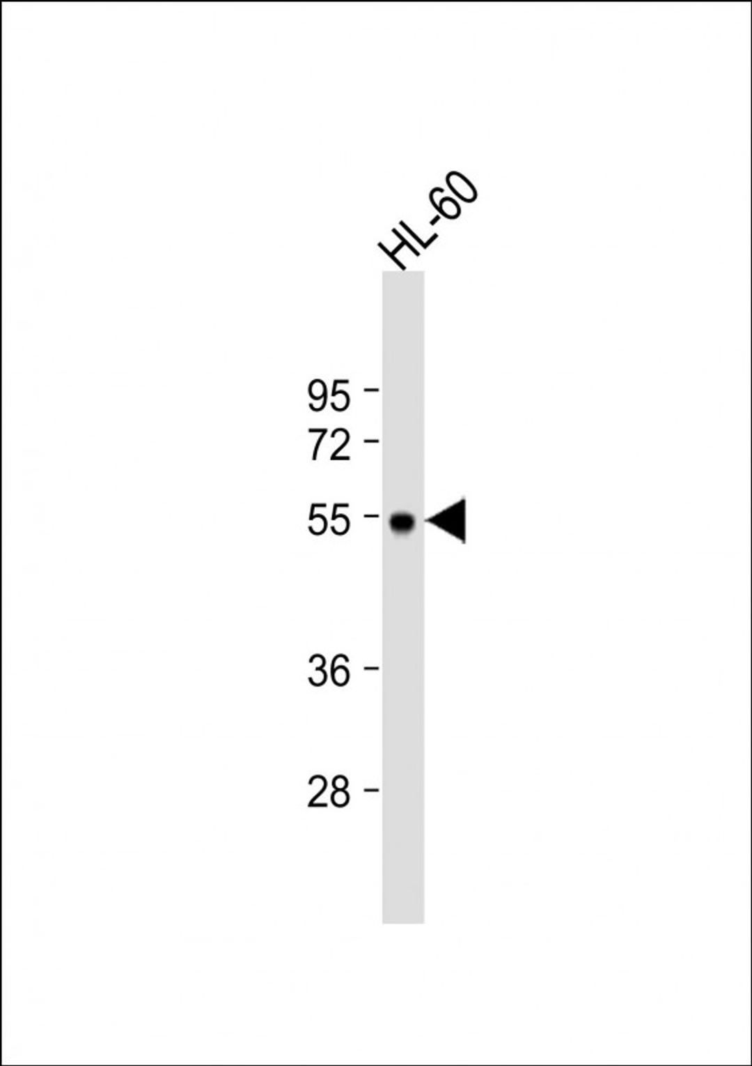 Western Blot at 1:1000 dilution + HL-60 whole cell lysate Lysates/proteins at 20 ug per lane.