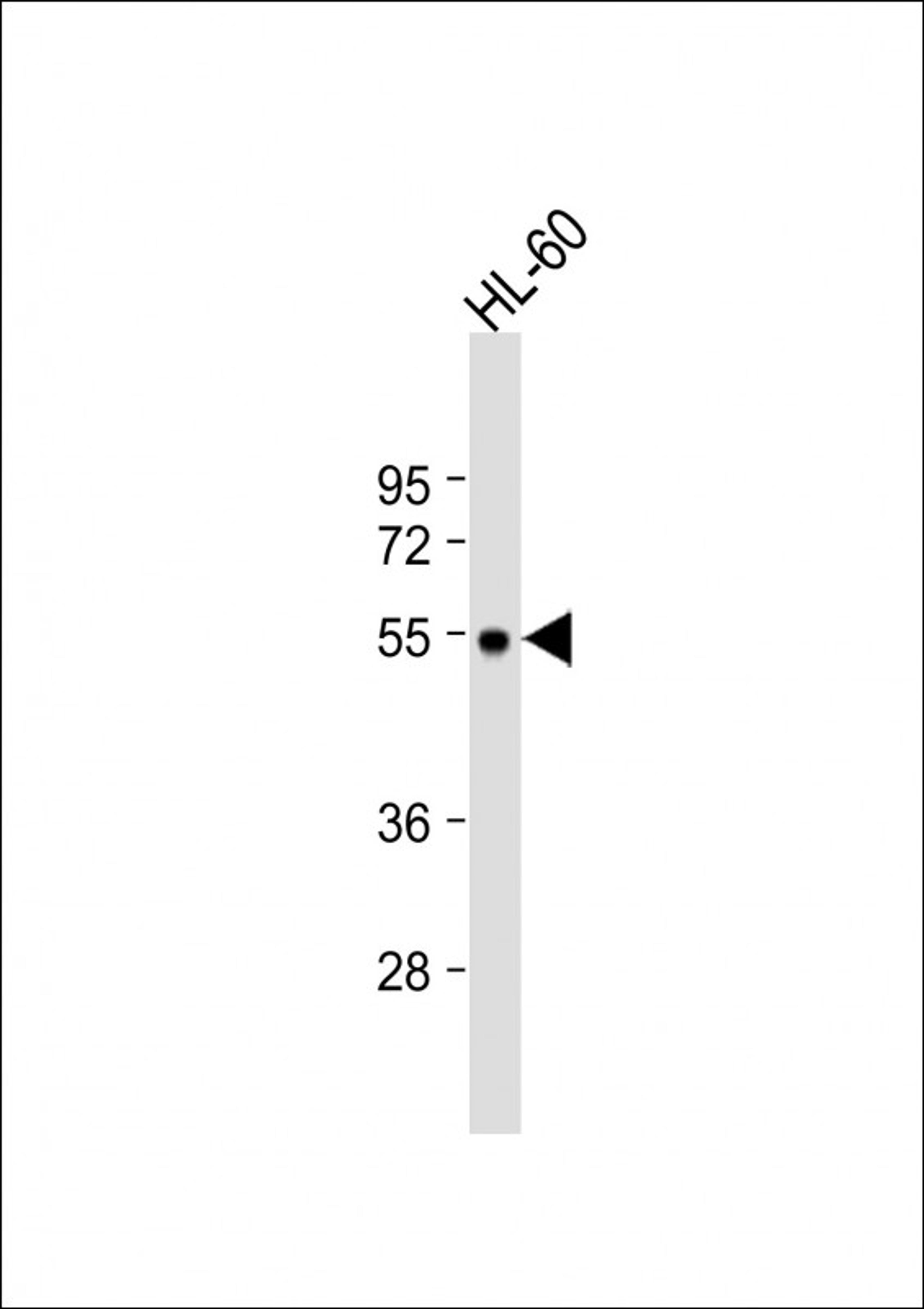 Western Blot at 1:1000 dilution + HL-60 whole cell lysate Lysates/proteins at 20 ug per lane.