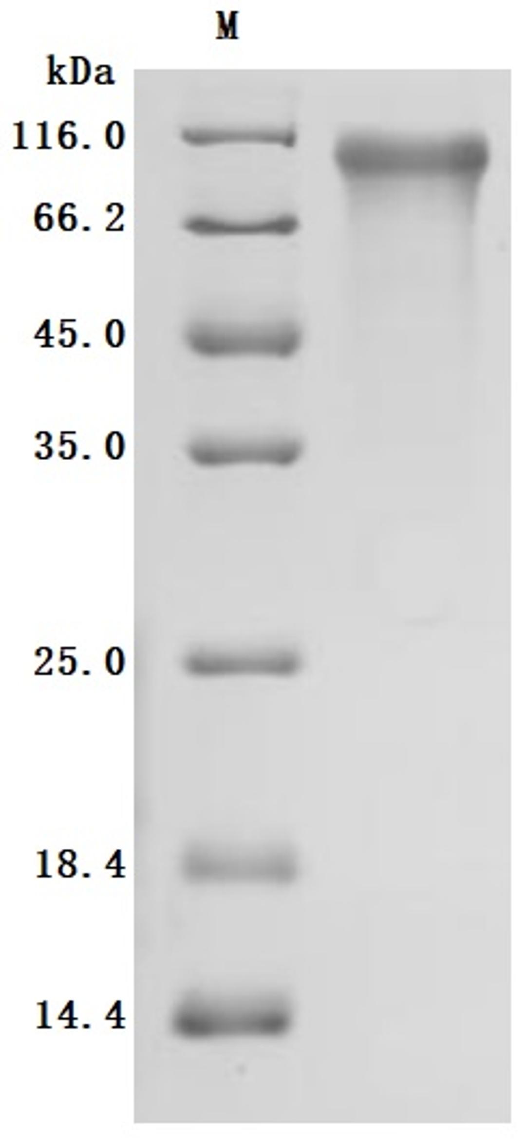 (Tris-Glycine gel) Discontinuous SDS-PAGE (reduced) with 5% enrichment gel and 15% separation gel.